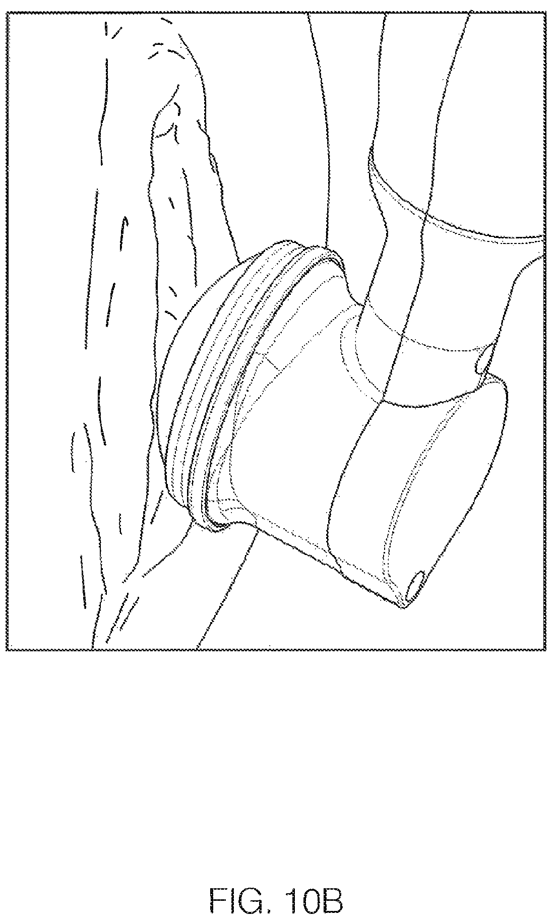 Patent US12599786 Figure 11 – Ultrasound device with attachable components