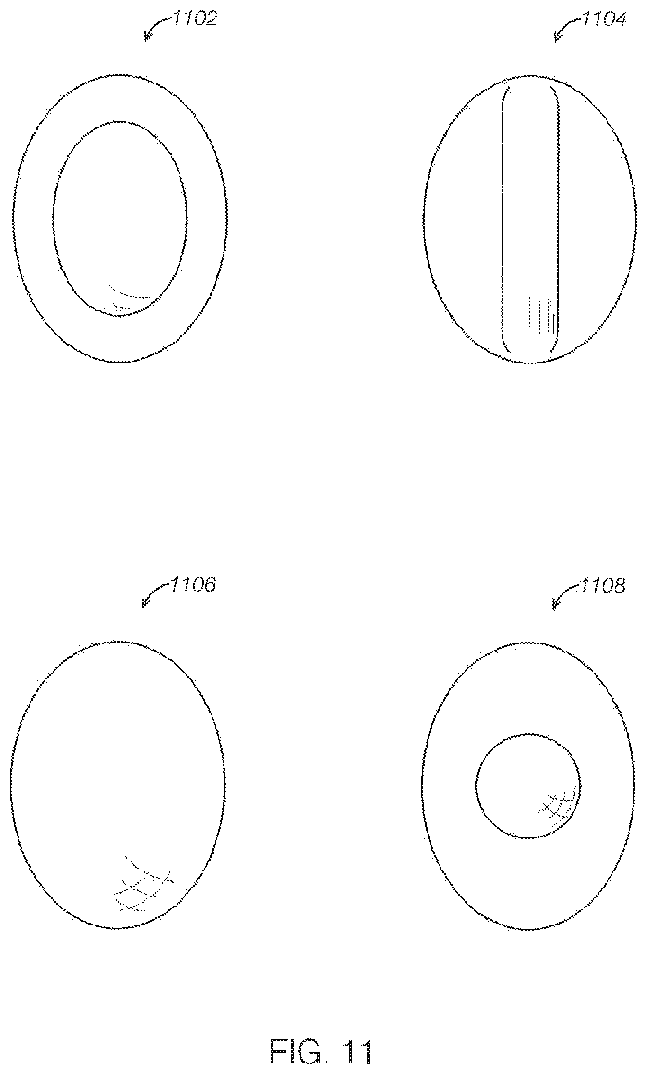 Patent US12599786 Figure 12 – Ultrasound device with attachable components