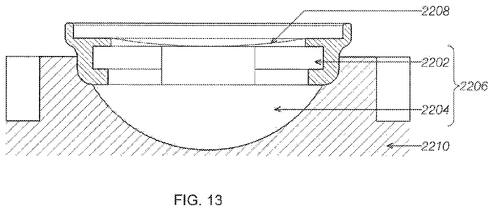 Patent US12599786 Figure 14 – Ultrasound device with attachable components