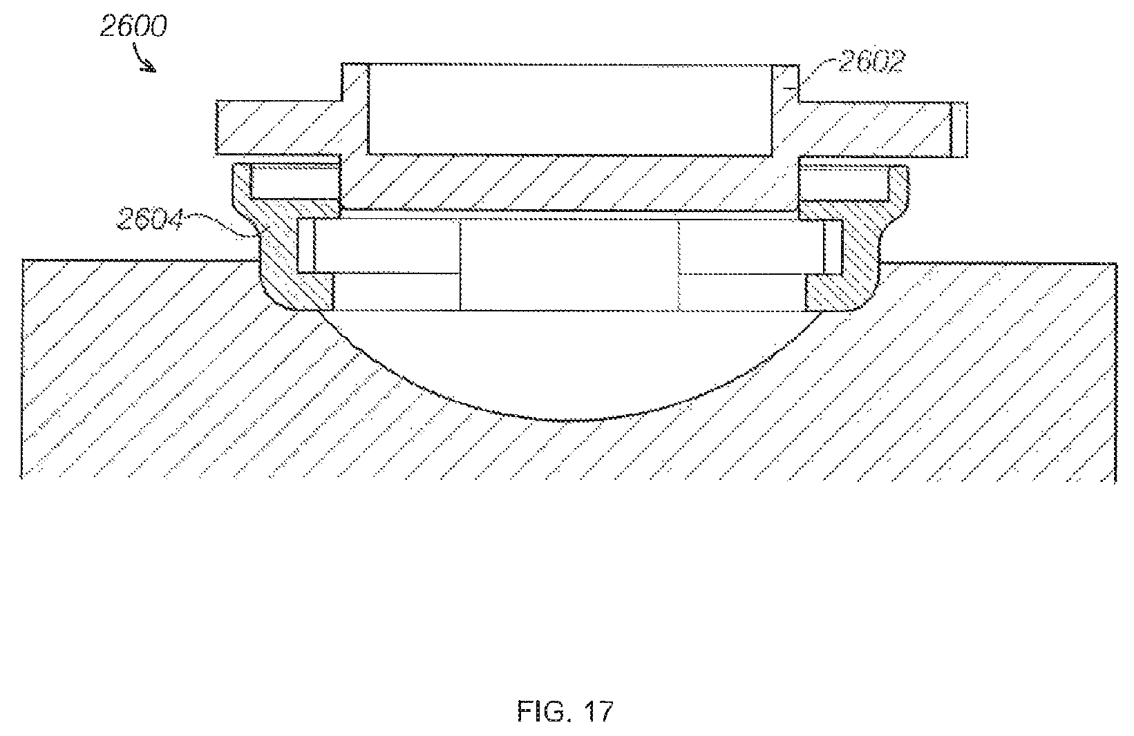 Patent US12599786 Figure 18 – Ultrasound device with attachable components