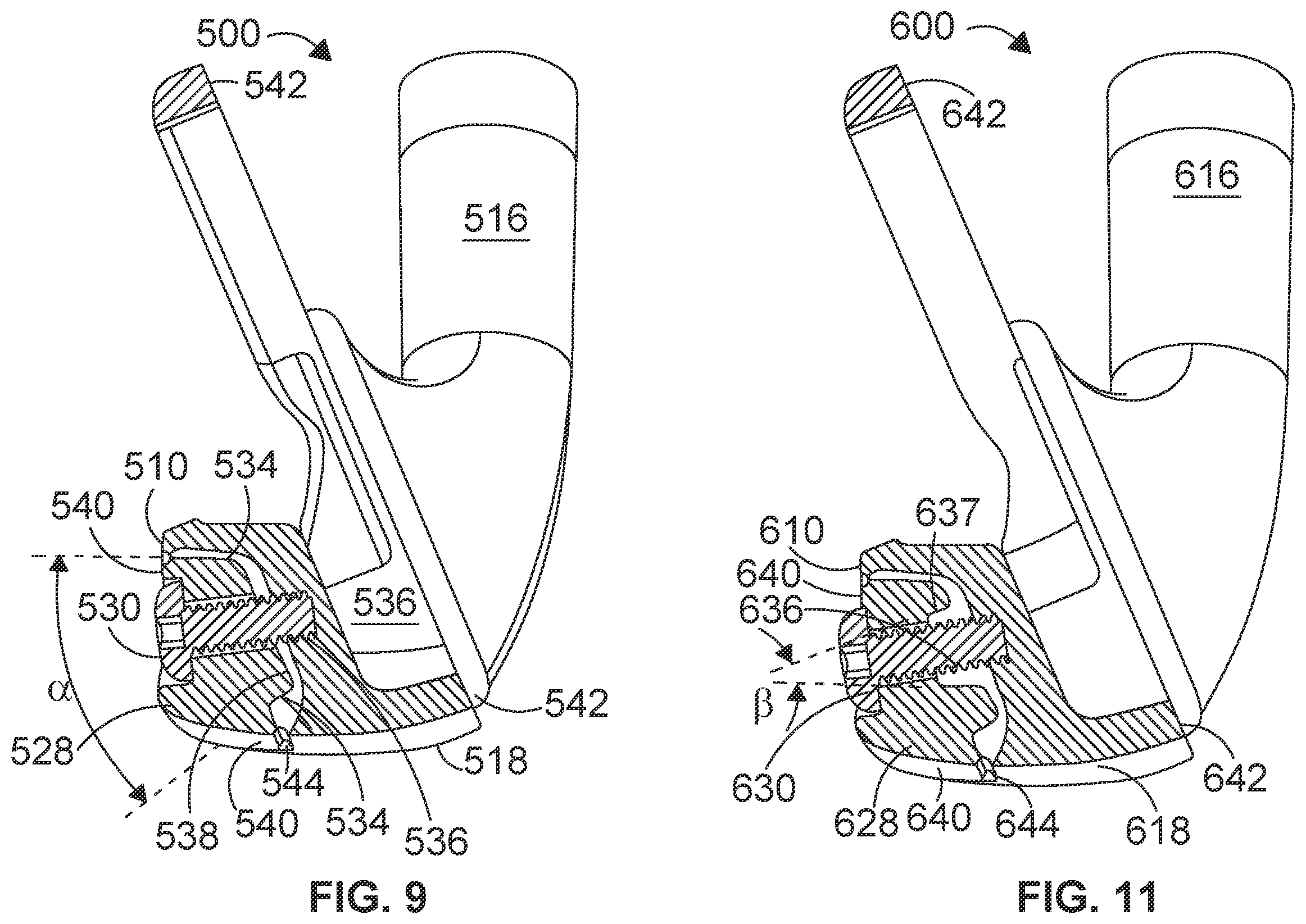 Patent US12599820 Figure 6 – Weighted iron set
