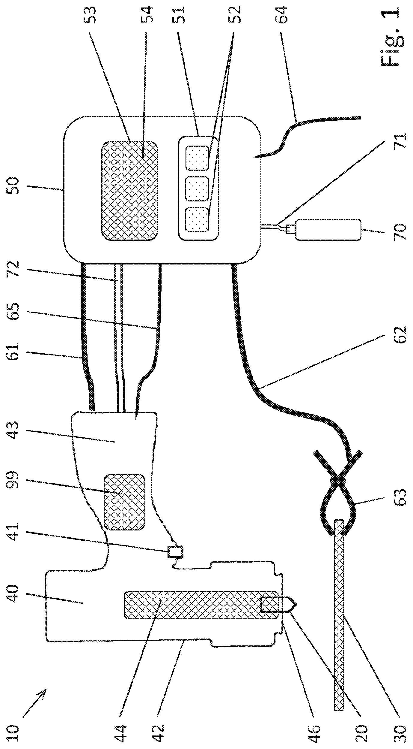 Patent US12599984 — Fastening method — Figure 1