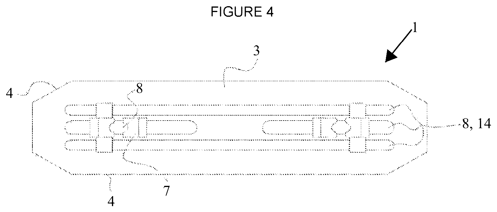 Patent US12599995 Figure 4 – Device or tool for gripping a liner to remove same from and install same in the shell of a mill, method for installing a liner and method for removing a liner