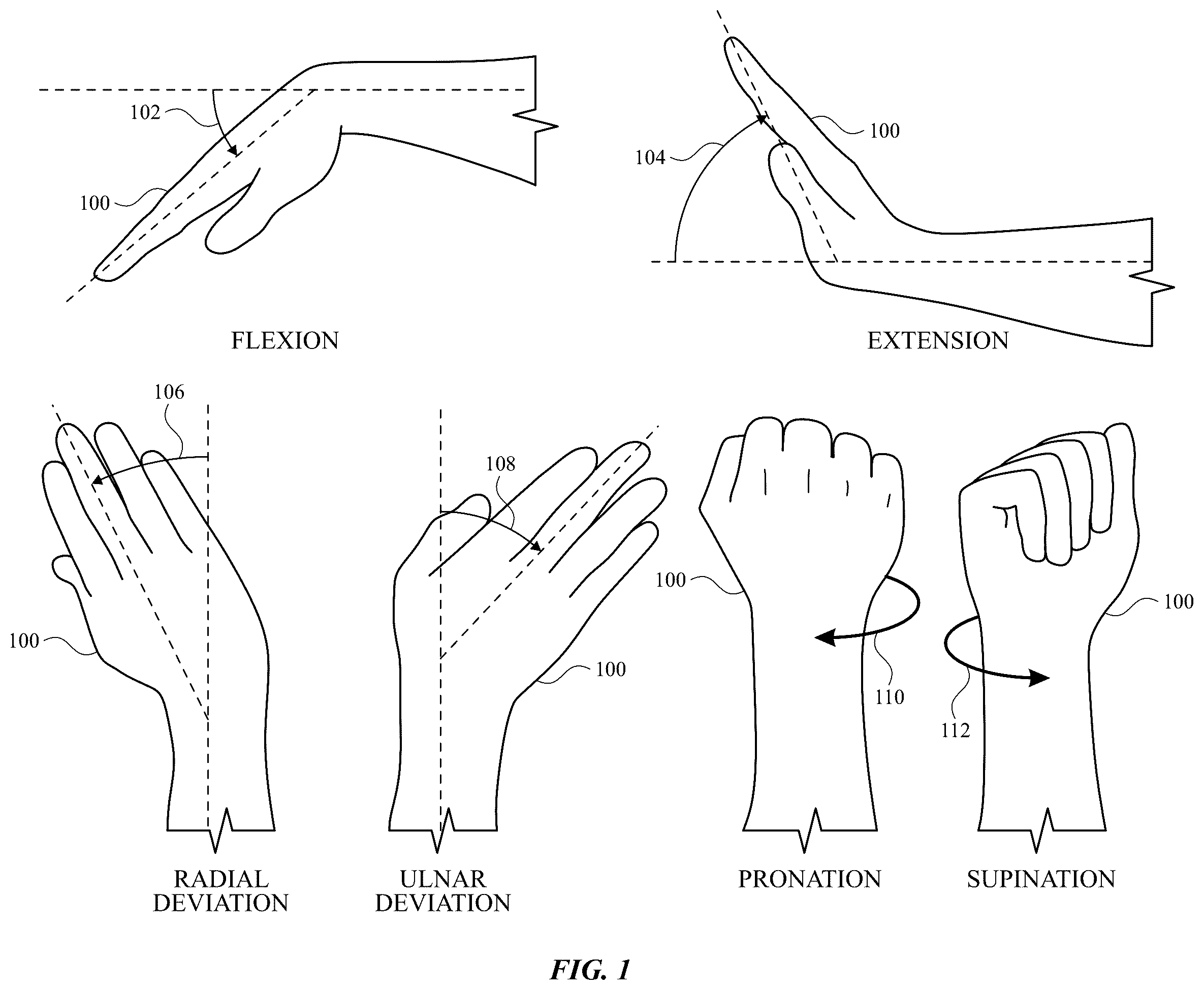 Patent US12602114 Figure 1 – Electrodes for gesture recognition
