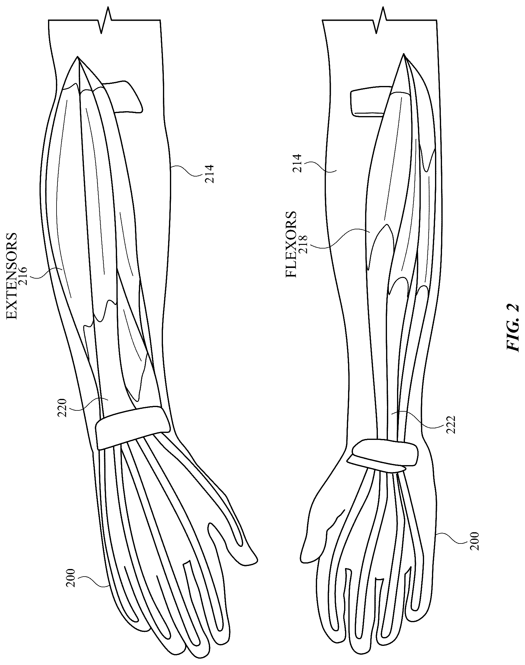 Patent US12602114 Figure 2 – Electrodes for gesture recognition