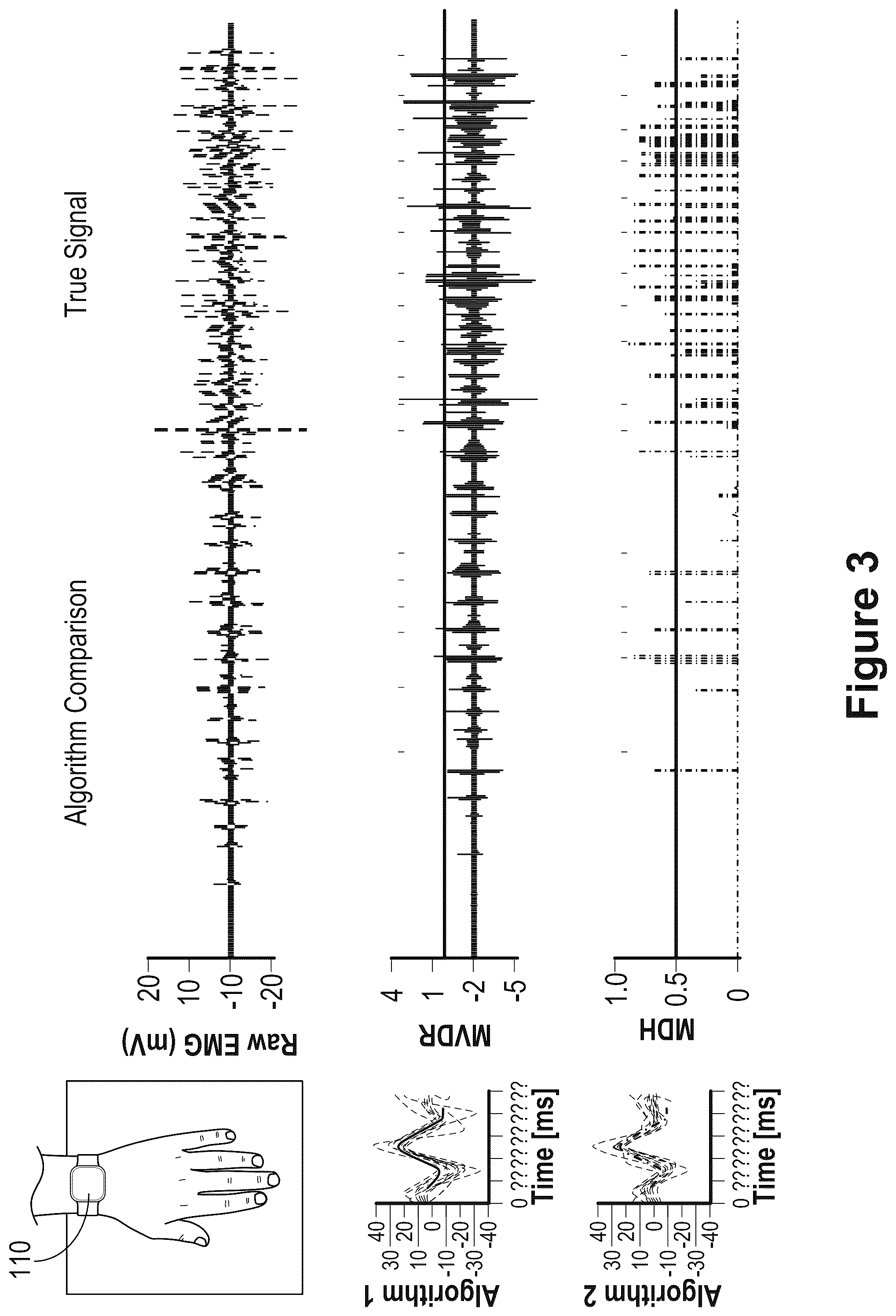 Patent US12602115 Figure 18 – Systems and methods for guiding users to perform detectable biopotential-based gestures tied to specific motor units, and actionable feedback associated therewith