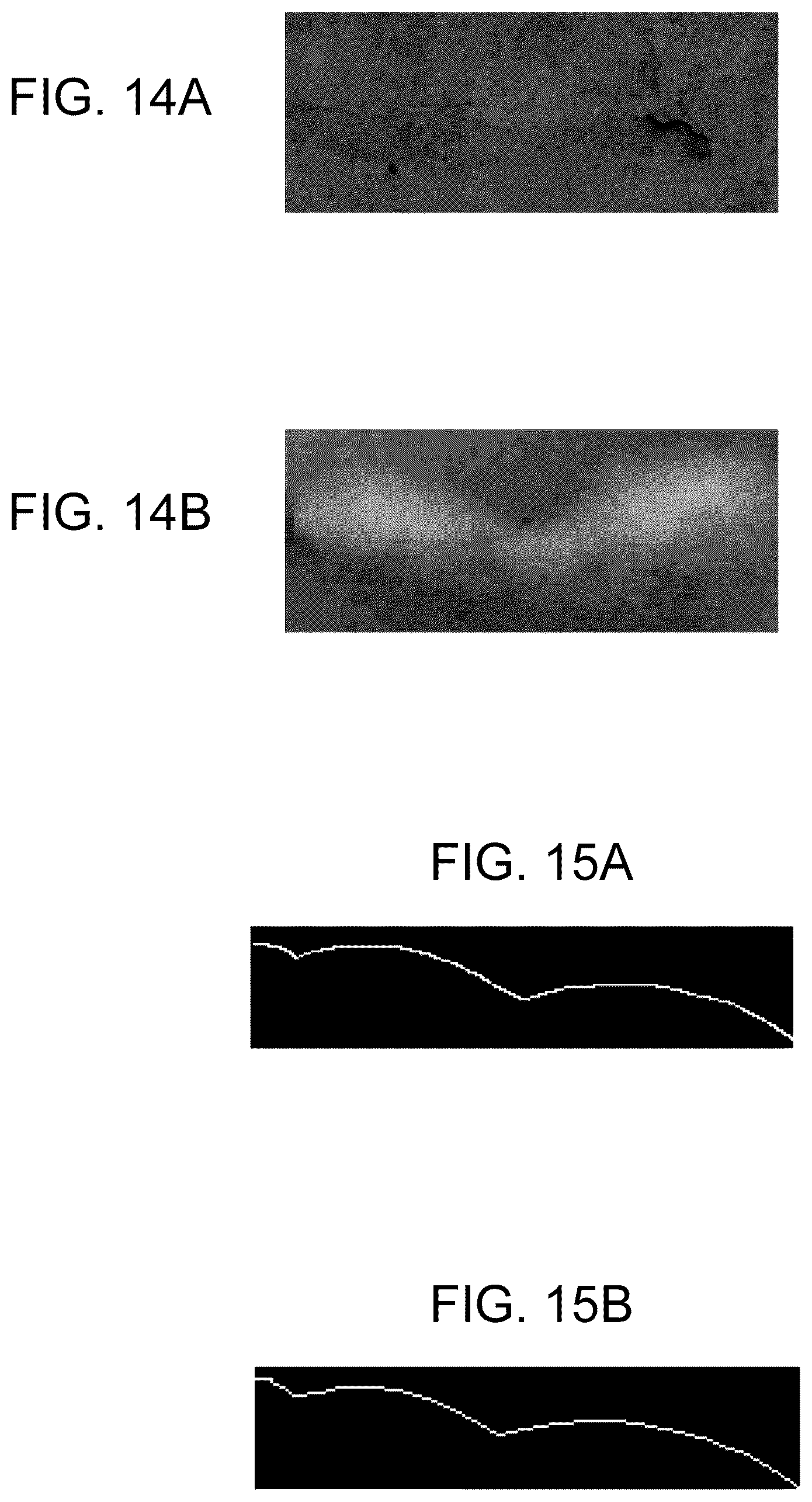 Patent US12602761 Figure 11 – Image analysis apparatus, image analysis method, and program