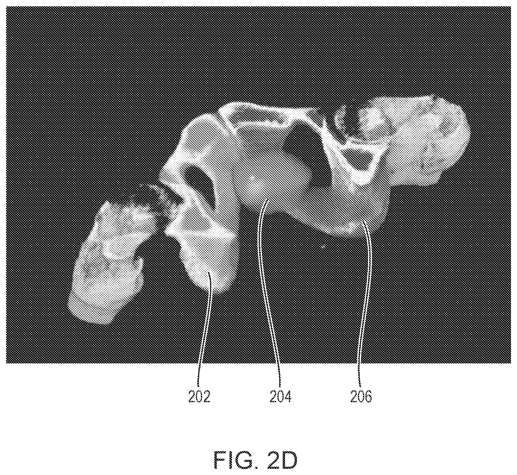 Patent US12602772 Figure 5 – Systems and methods for rapid neural network-based image segmentation and radiopharmaceutical uptake determination