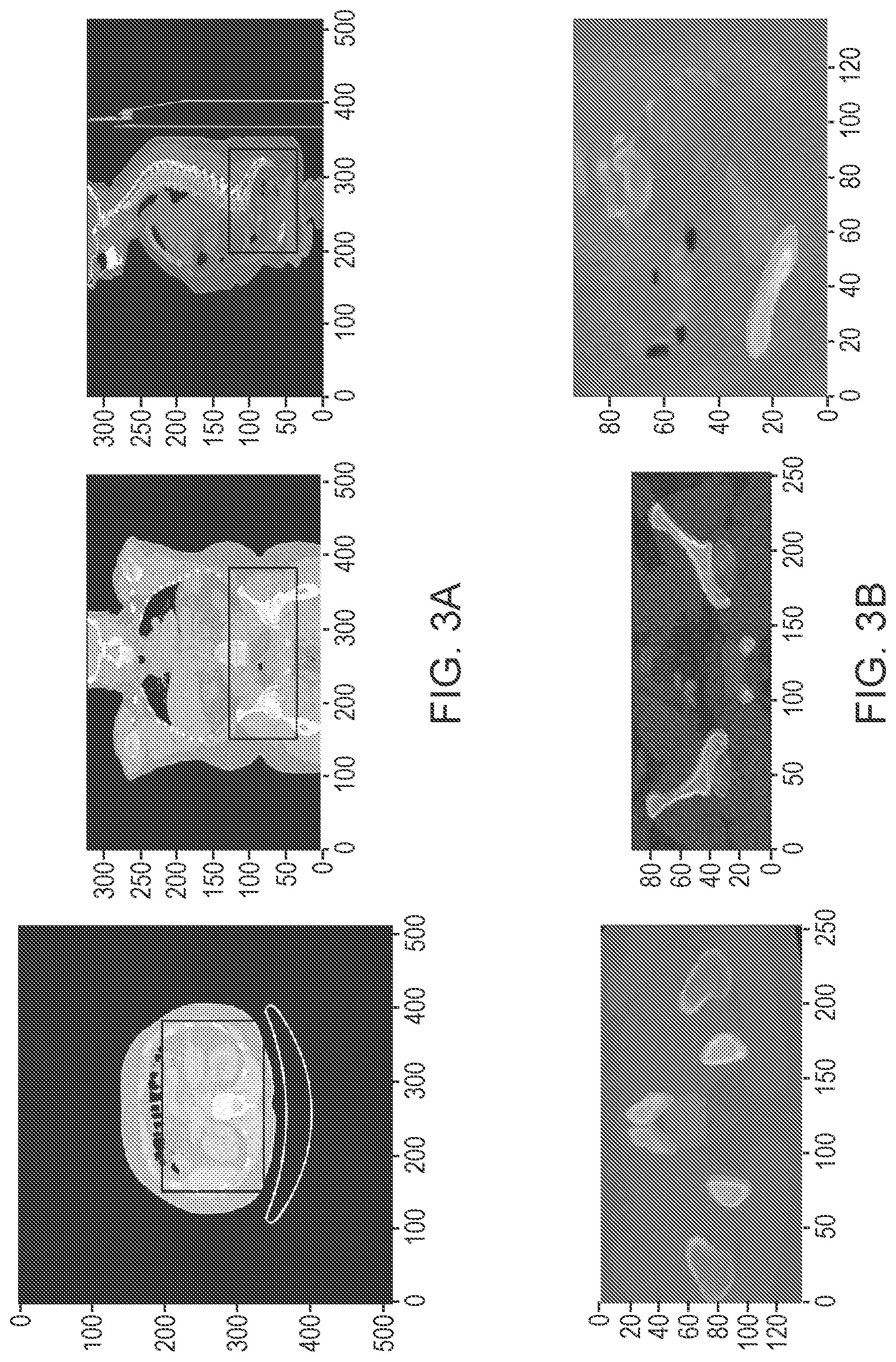 Patent US12602772 Figure 7 – Systems and methods for rapid neural network-based image segmentation and radiopharmaceutical uptake determination