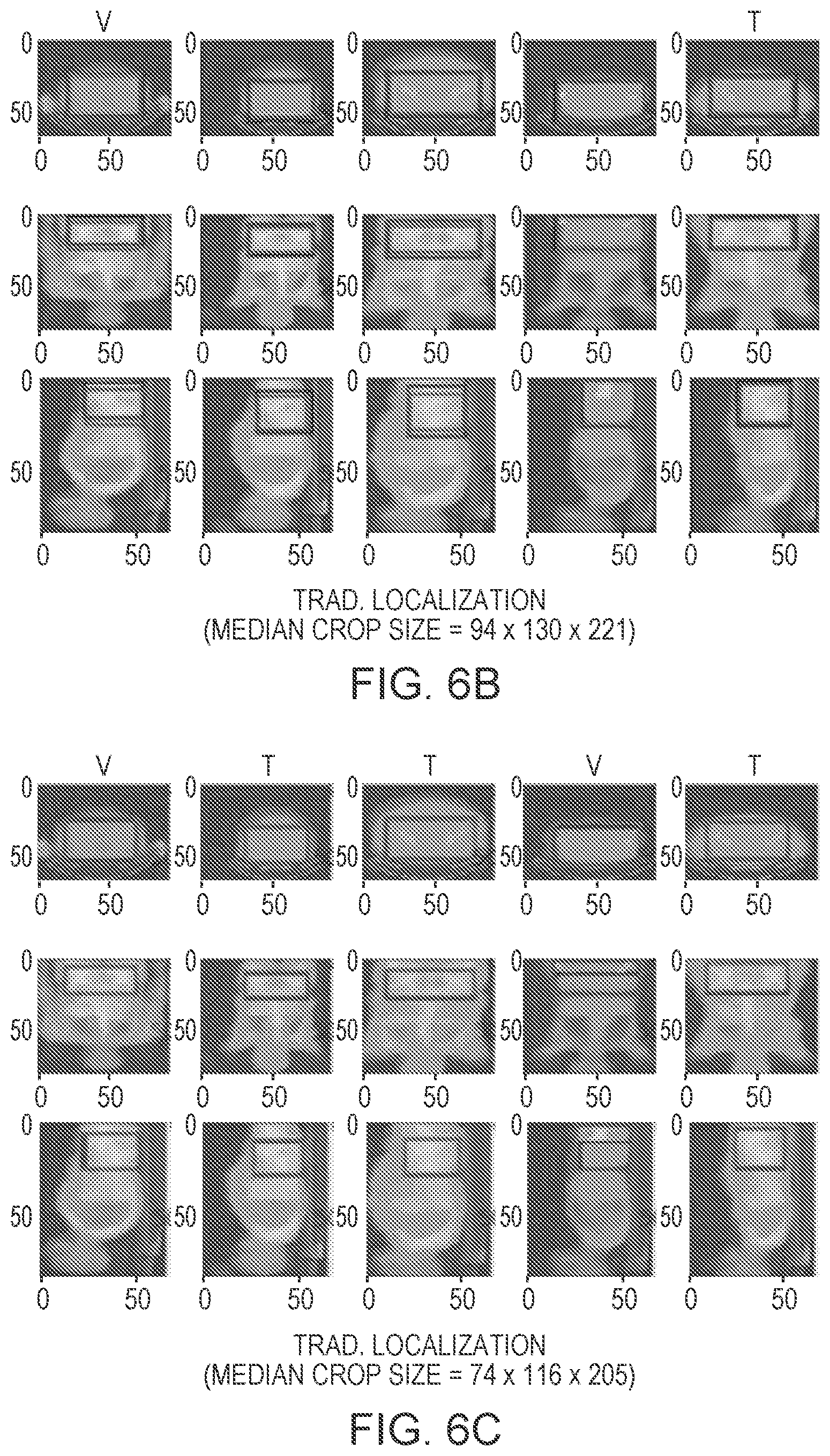 Patent US12602772 Figure 11 – Systems and methods for rapid neural network-based image segmentation and radiopharmaceutical uptake determination