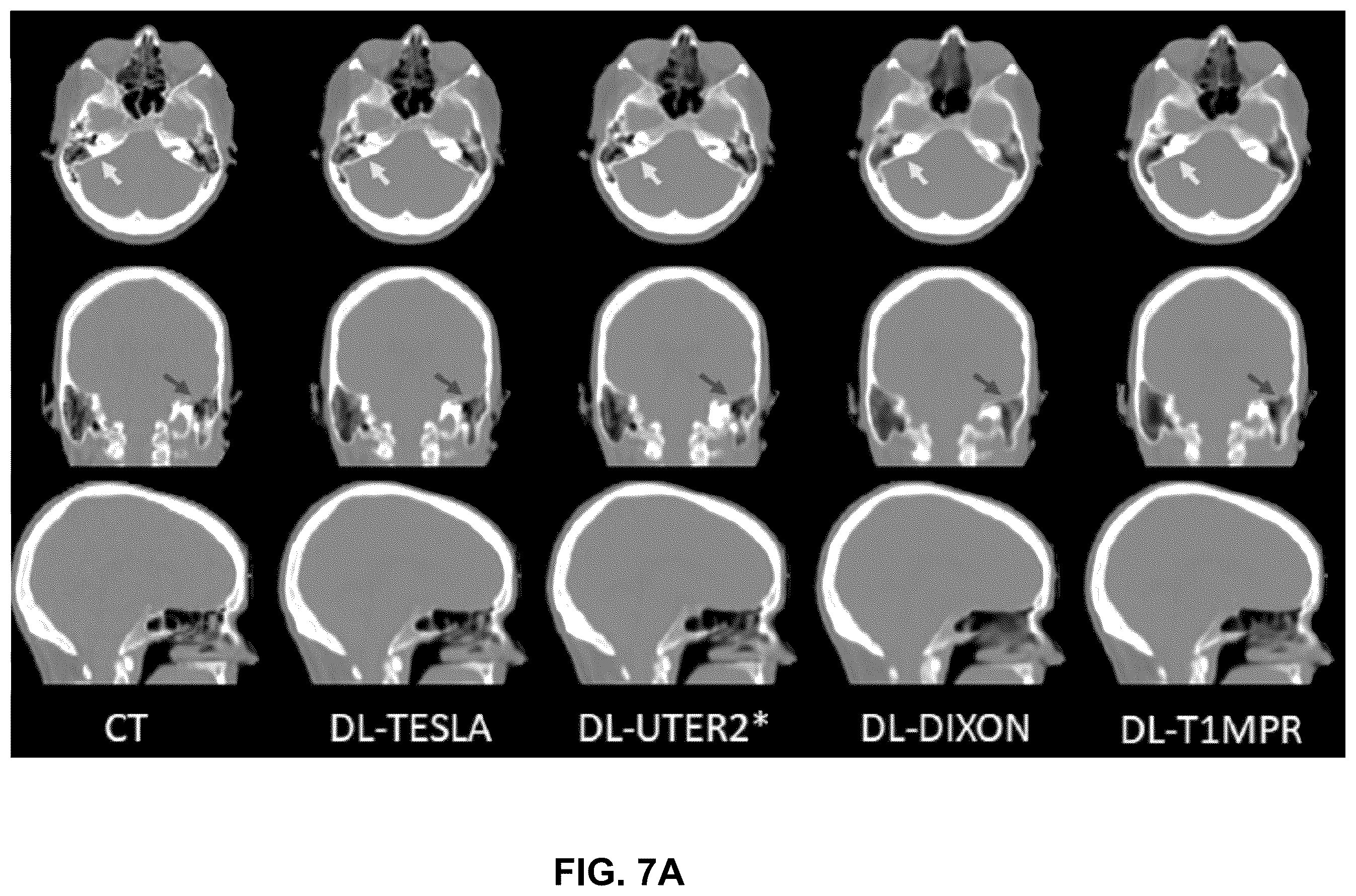 Patent US12602773 Figure 9 – Deep-learning-based T1-enhanced selection of linear coefficients (DL-TESLA) for PET/MR attenuation correction