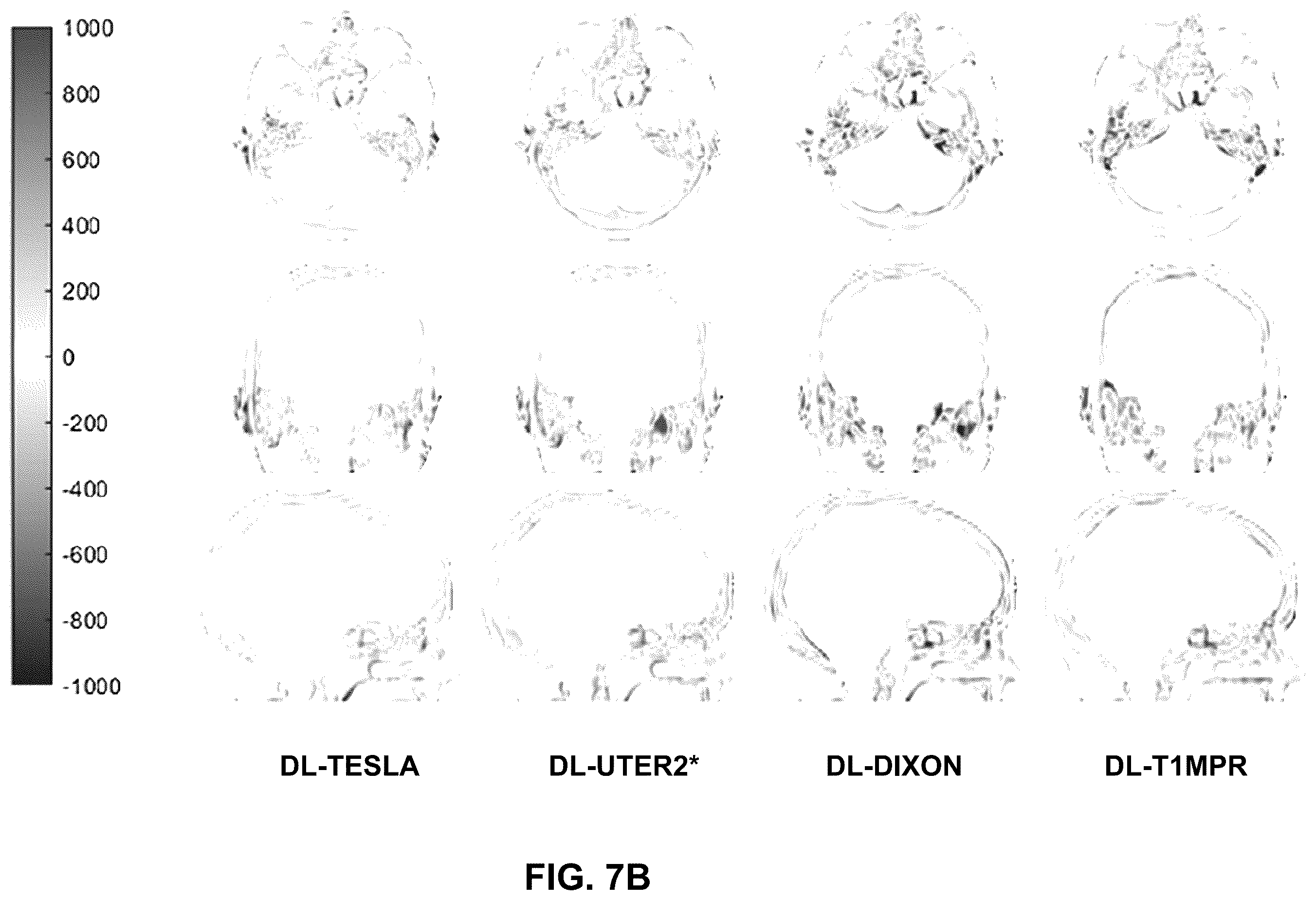 Patent US12602773 Figure 10 – Deep-learning-based T1-enhanced selection of linear coefficients (DL-TESLA) for PET/MR attenuation correction