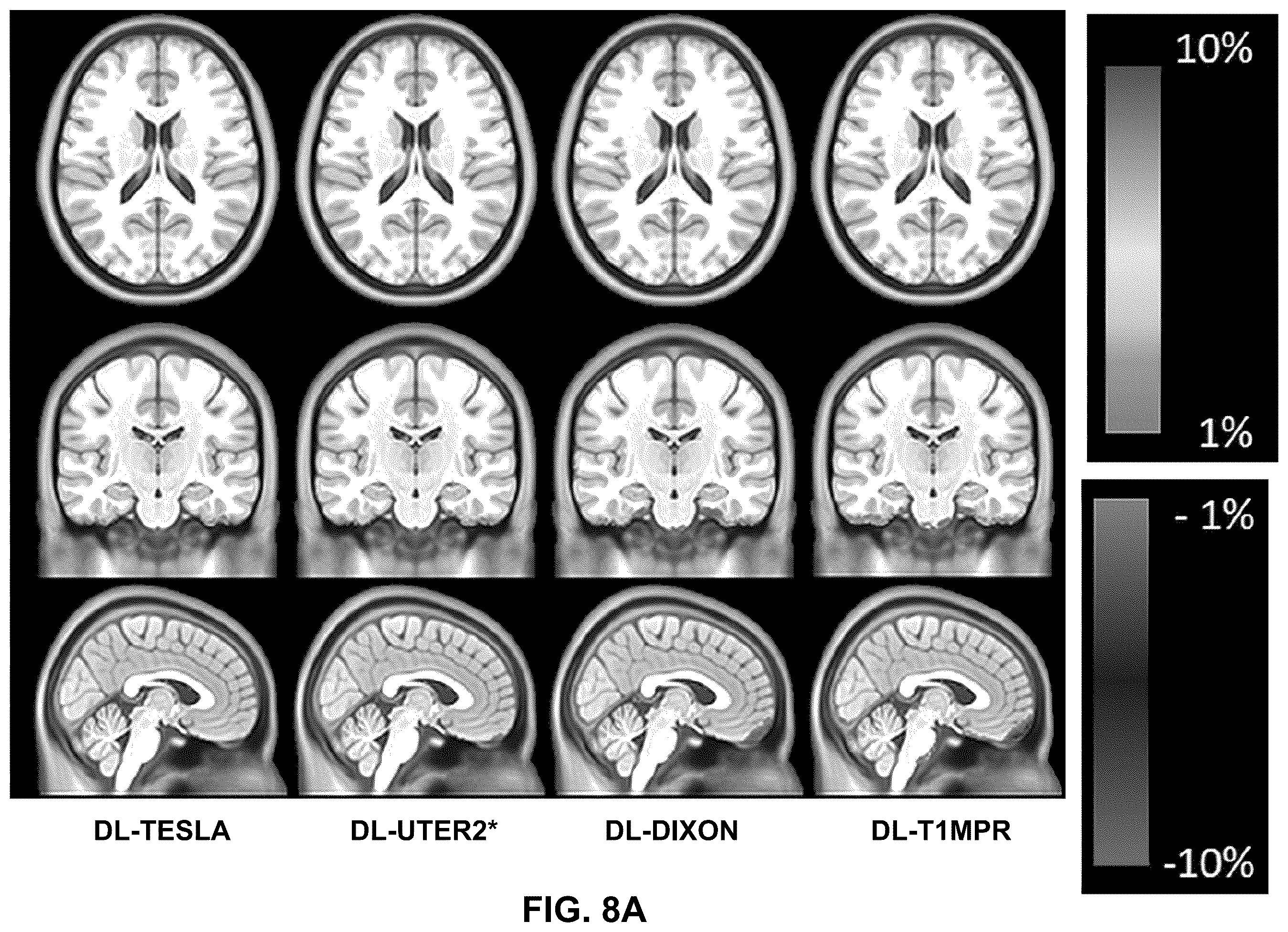 Patent US12602773 Figure 11 – Deep-learning-based T1-enhanced selection of linear coefficients (DL-TESLA) for PET/MR attenuation correction