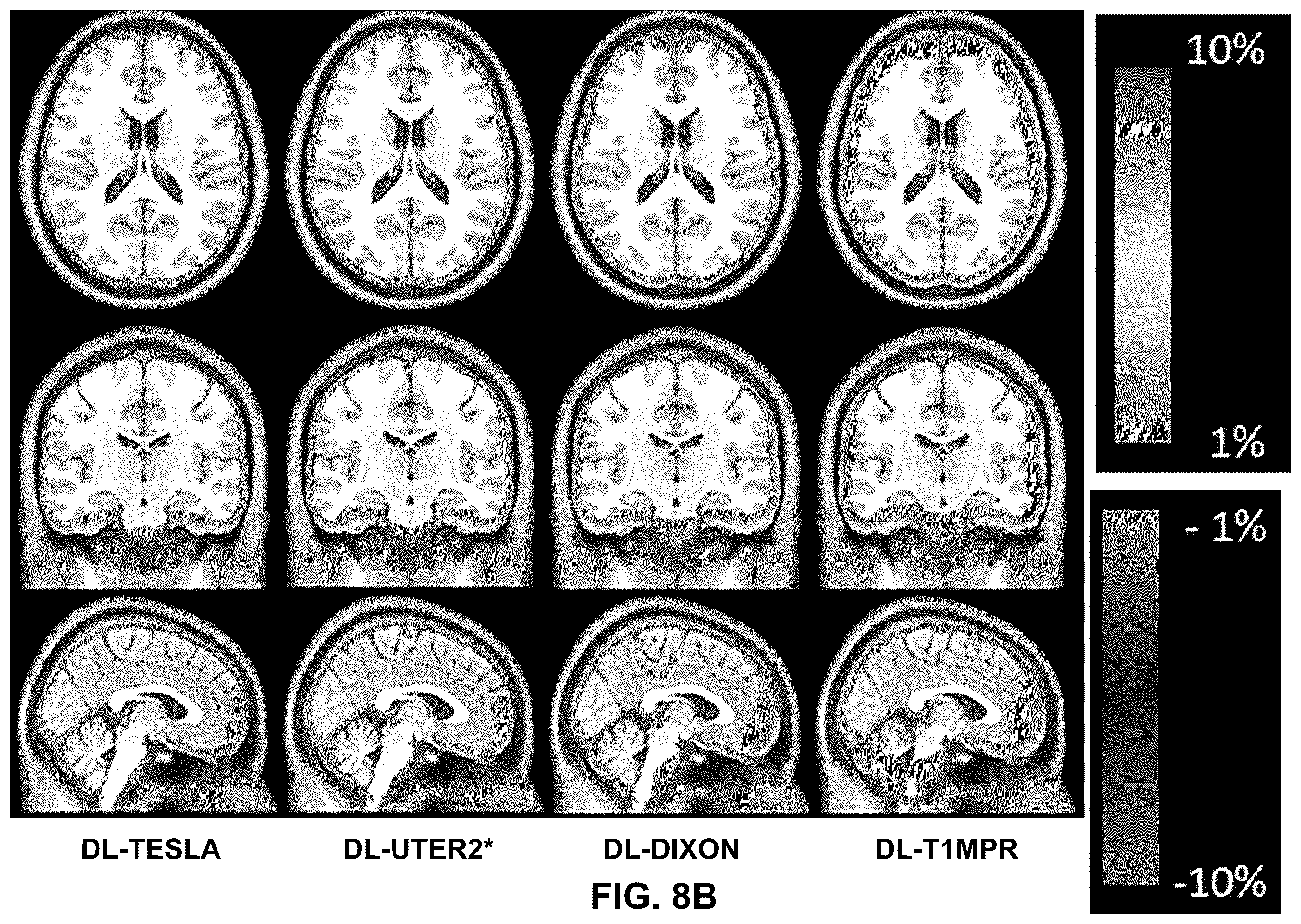 Patent US12602773 Figure 12 – Deep-learning-based T1-enhanced selection of linear coefficients (DL-TESLA) for PET/MR attenuation correction