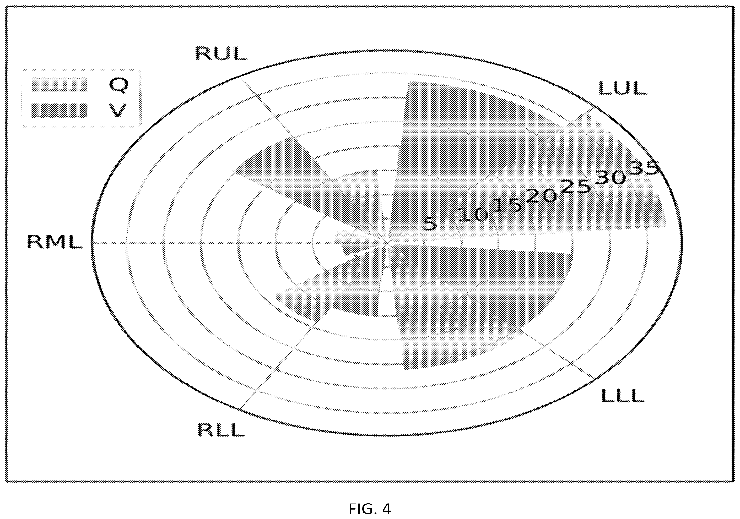Patent US12602774 Figure 4 – Regional pulmonary V/Q via image registration and multi-energy CT