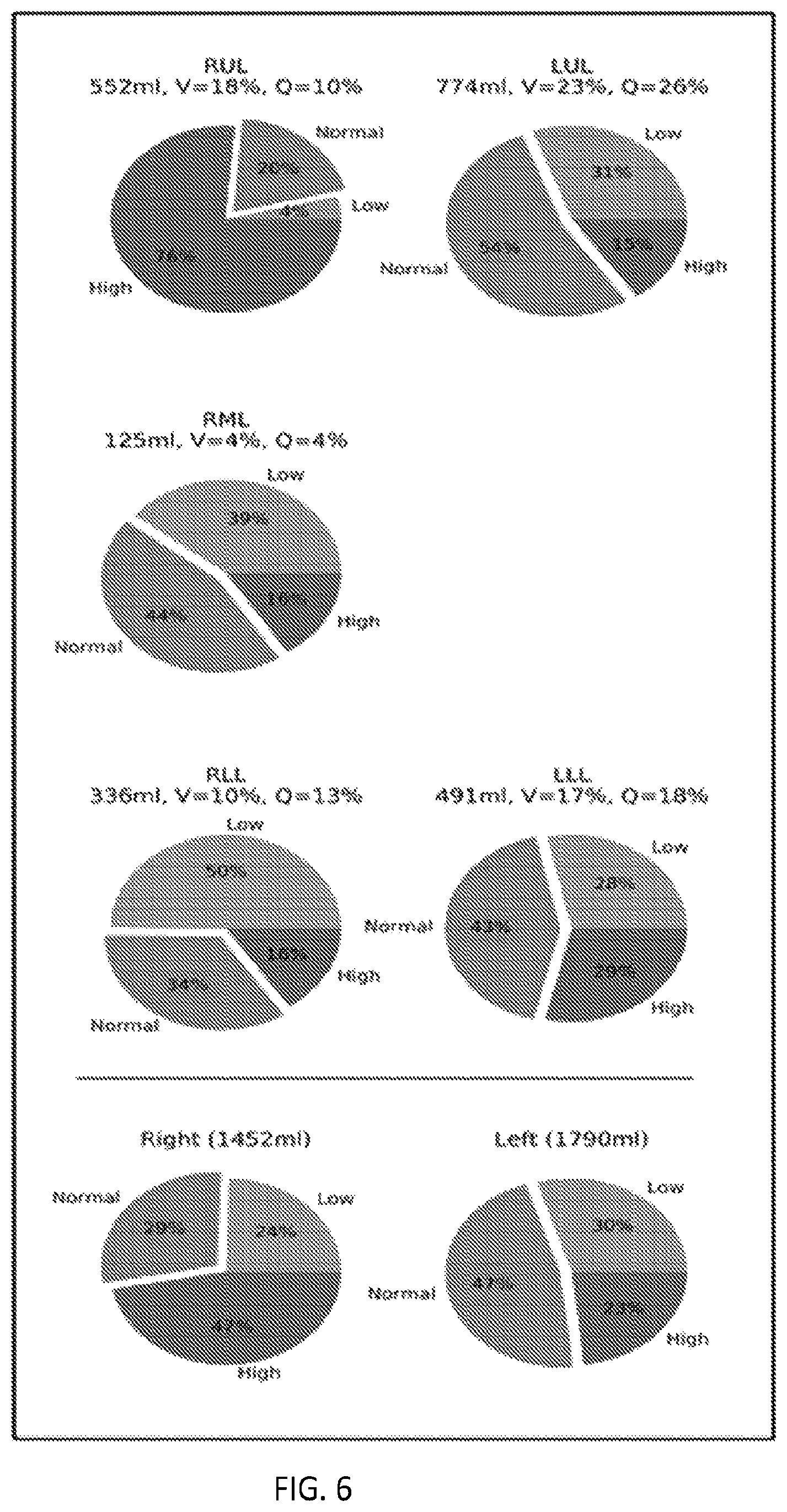 Patent US12602774 Figure 6 – Regional pulmonary V/Q via image registration and multi-energy CT