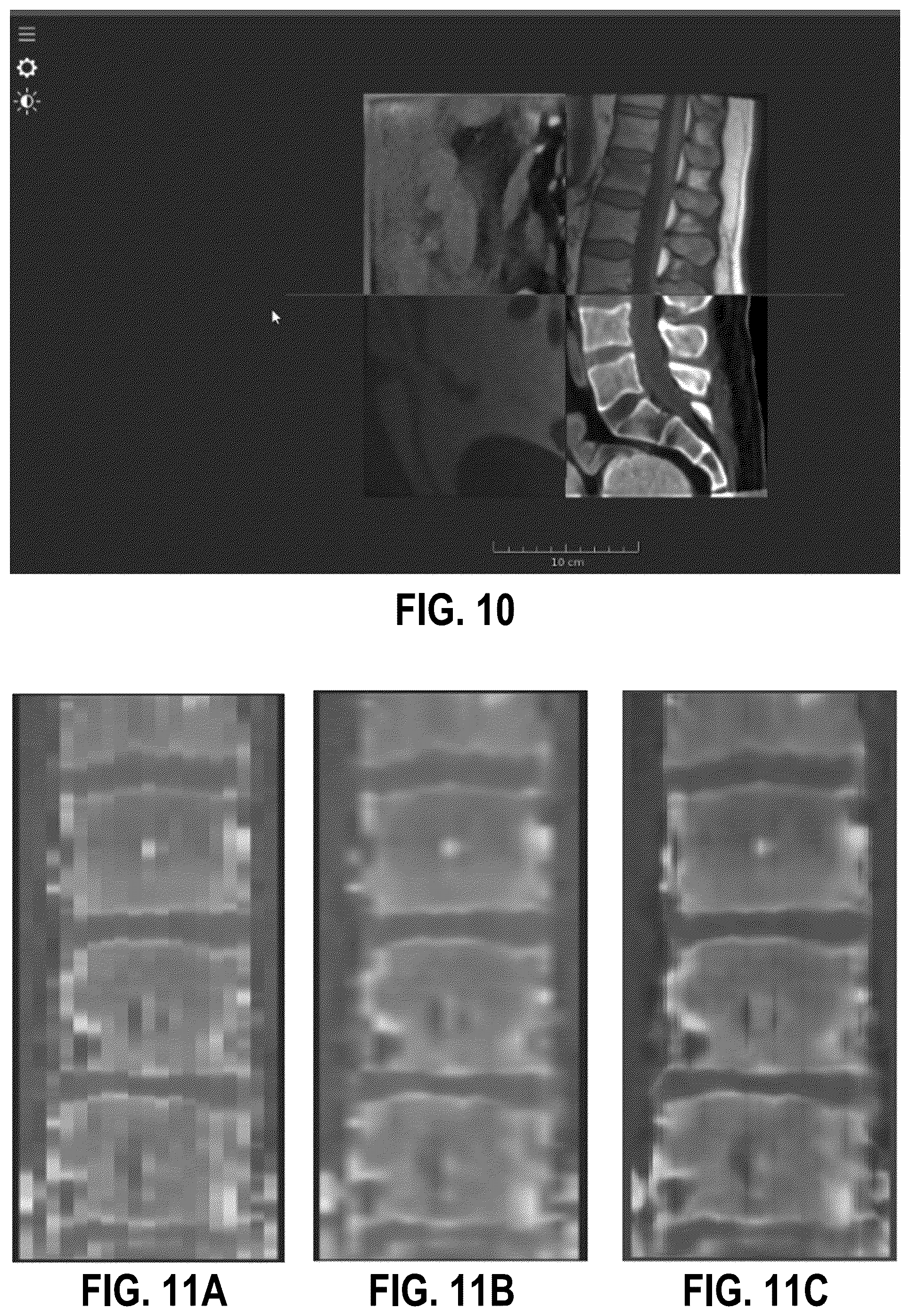 Patent US12602775 Figure 9 – Interpolation of medical images