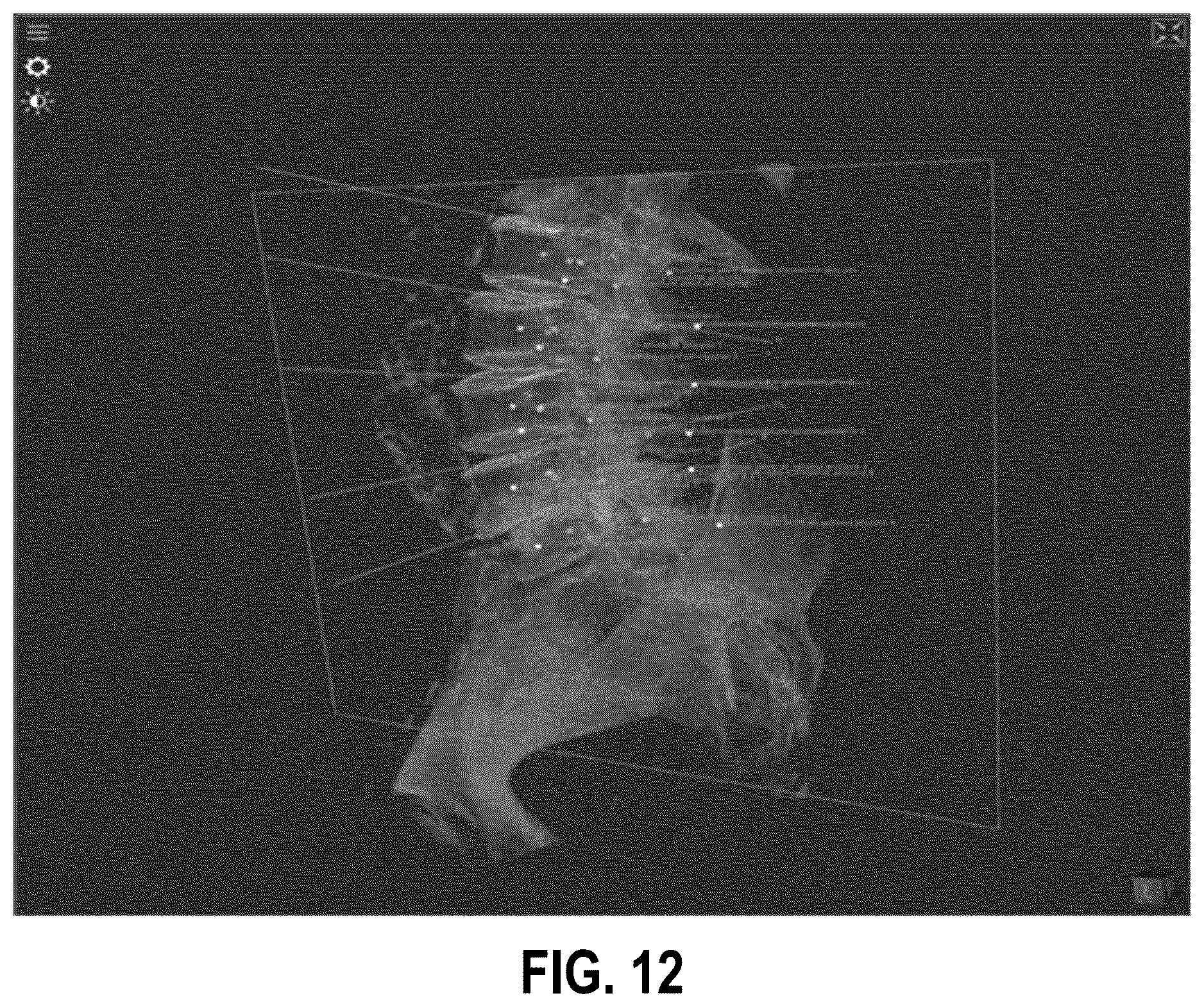 Patent US12602775 Figure 10 – Interpolation of medical images
