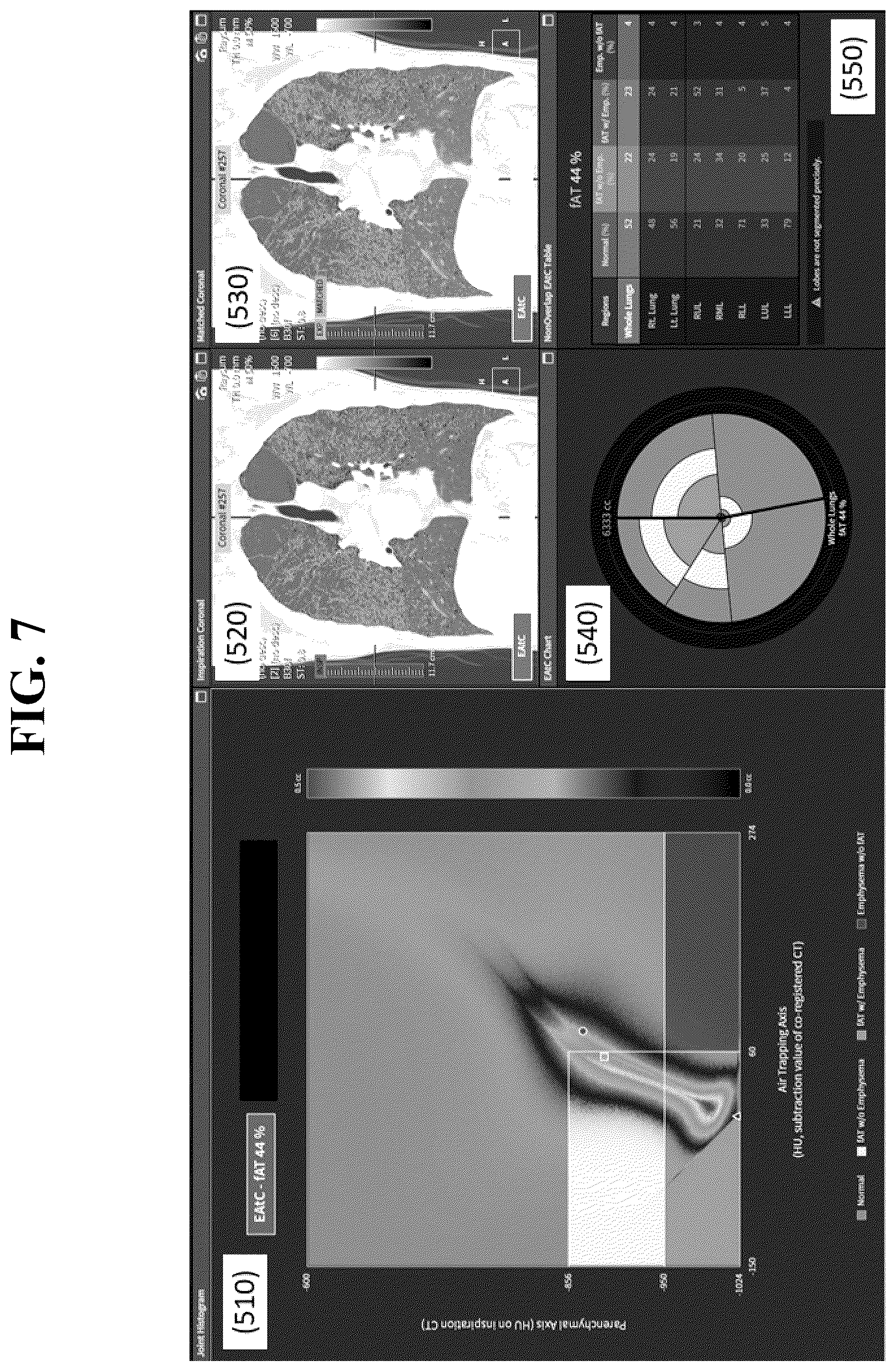 Patent US12602777 Figure 7 – Apparatus and method for quantitative assessment of medical images for diagnosis of chronic obstructive pulmonary disease