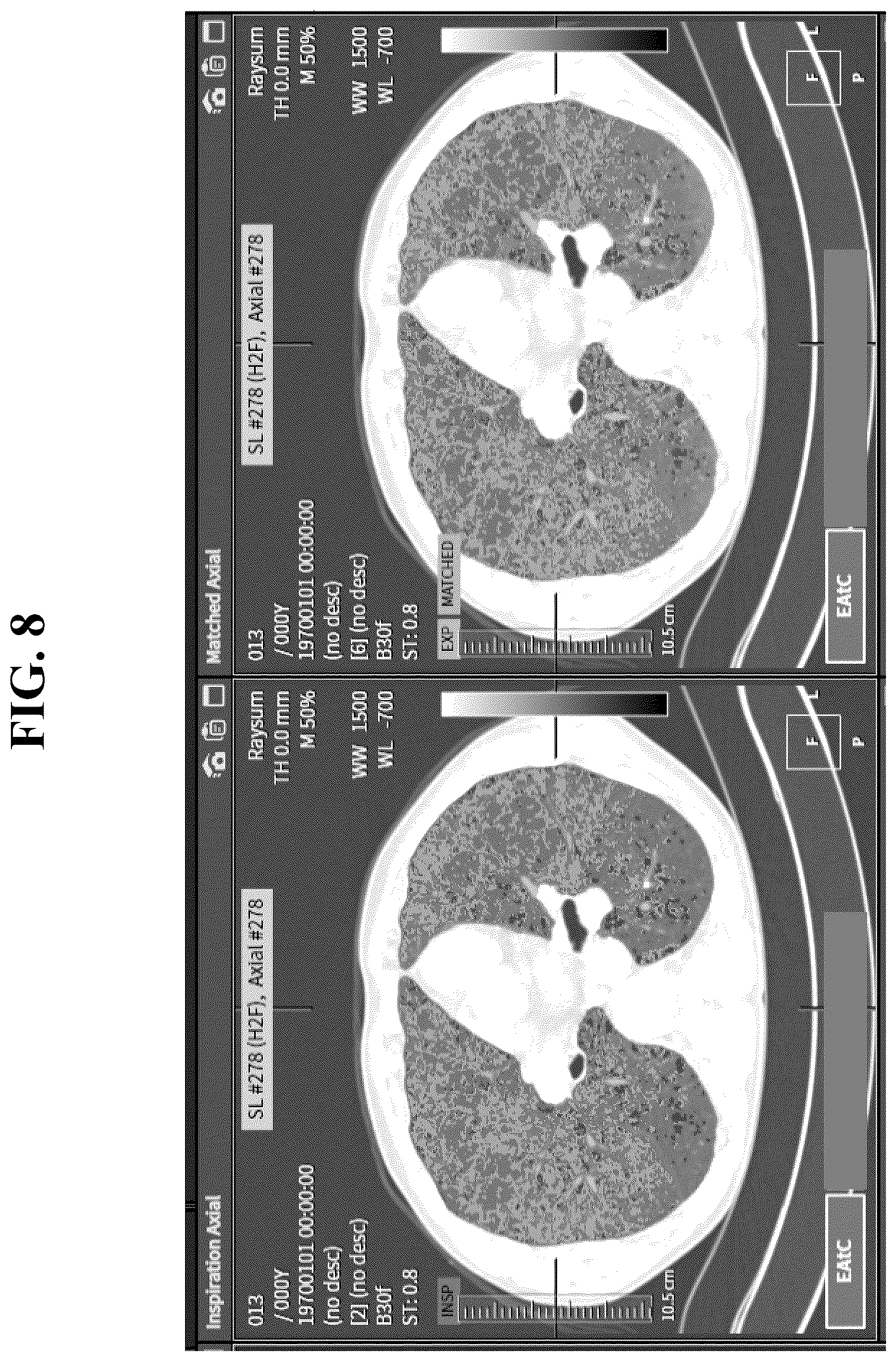 Patent US12602777 Figure 8 – Apparatus and method for quantitative assessment of medical images for diagnosis of chronic obstructive pulmonary disease