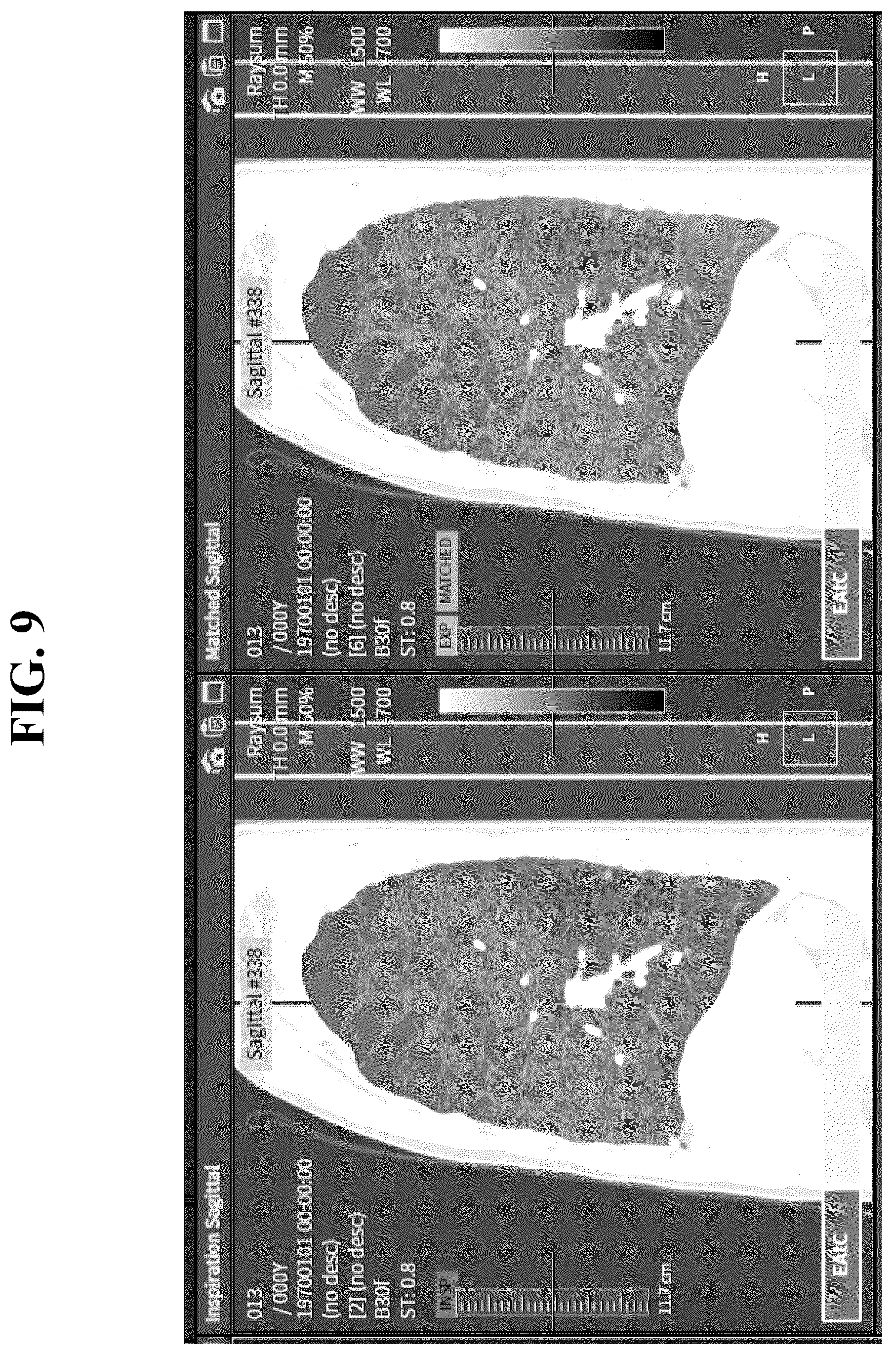 Patent US12602777 Figure 9 – Apparatus and method for quantitative assessment of medical images for diagnosis of chronic obstructive pulmonary disease