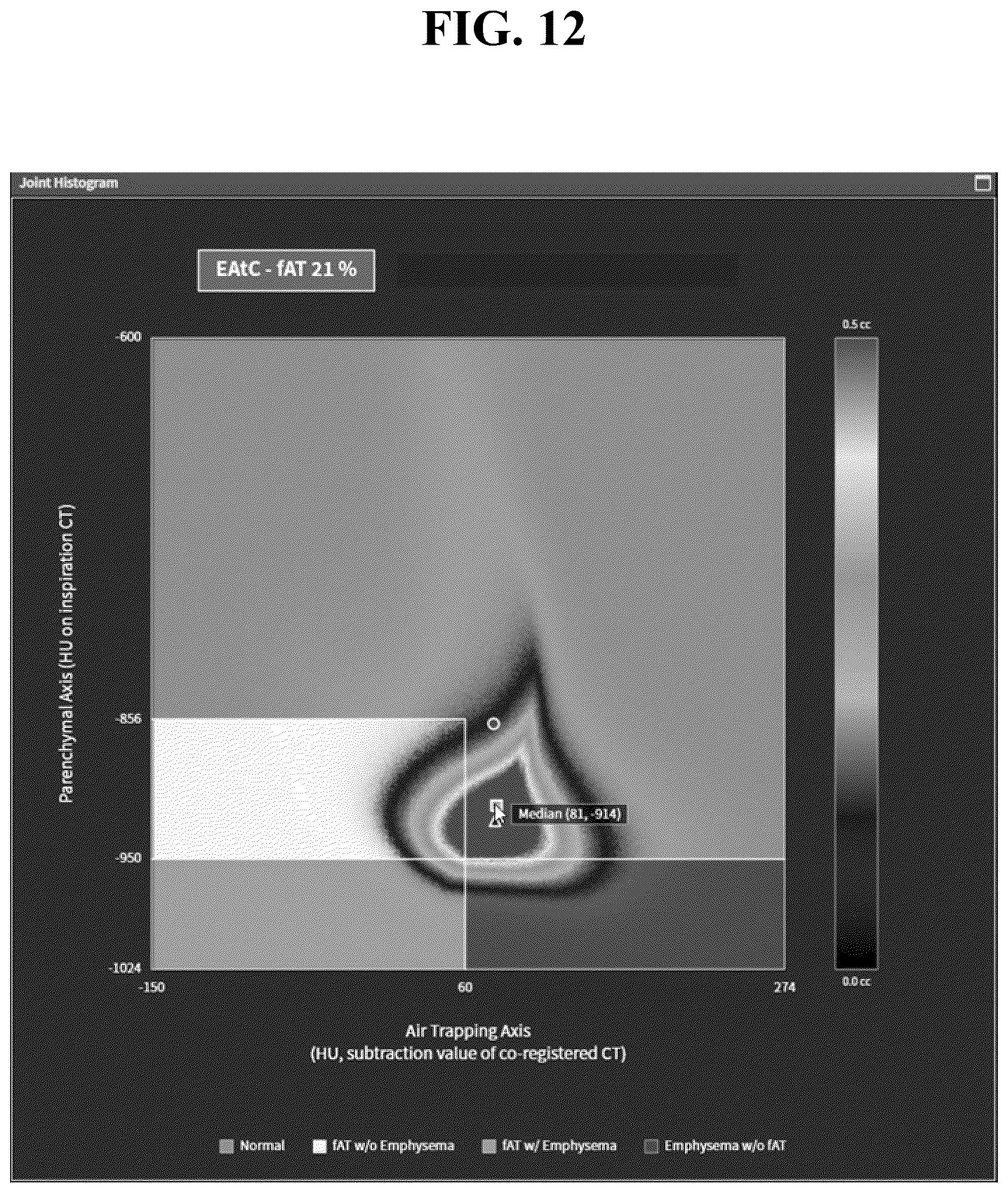 Patent US12602777 Figure 12 – Apparatus and method for quantitative assessment of medical images for diagnosis of chronic obstructive pulmonary disease