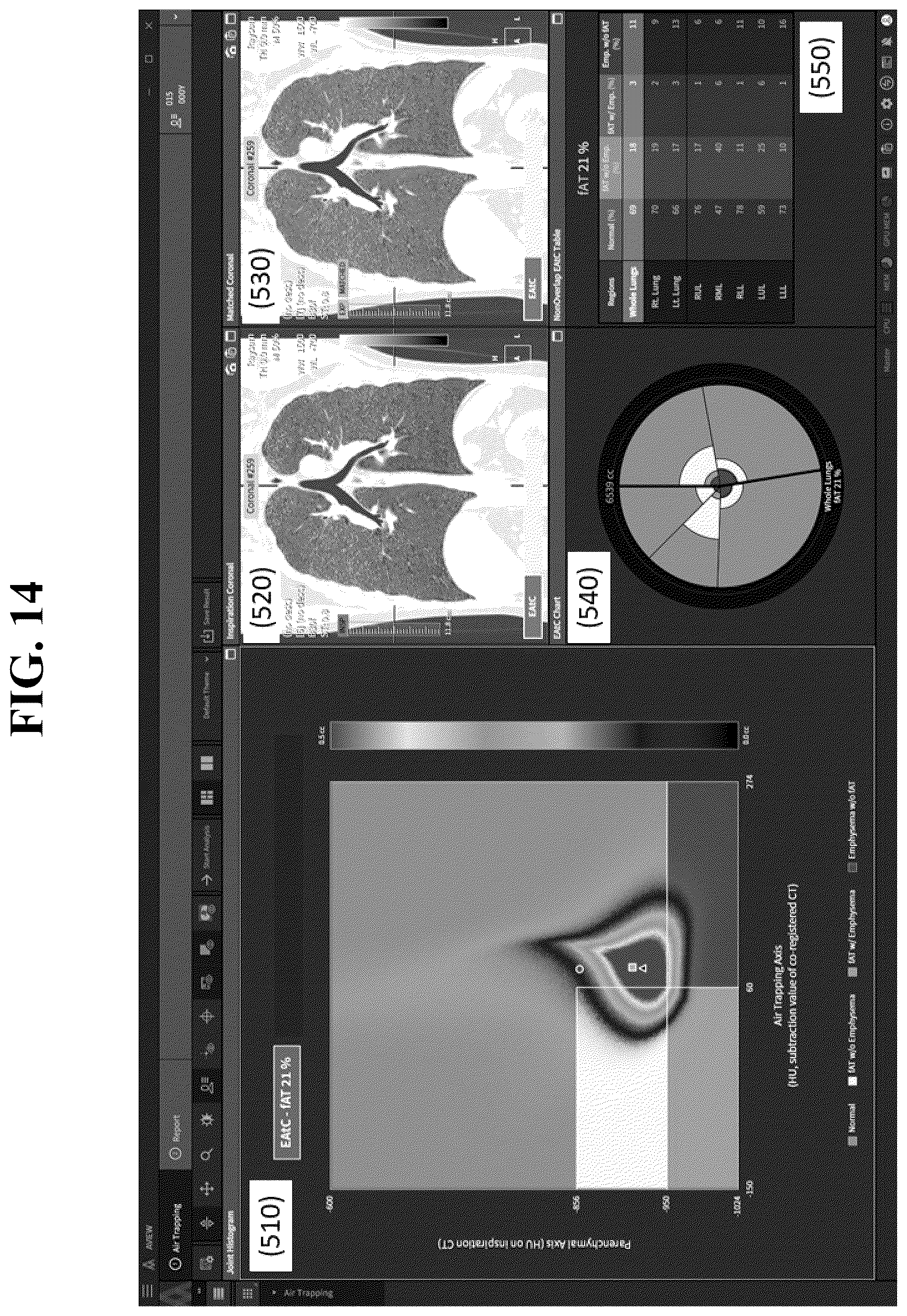 Patent US12602777 Figure 14 – Apparatus and method for quantitative assessment of medical images for diagnosis of chronic obstructive pulmonary disease