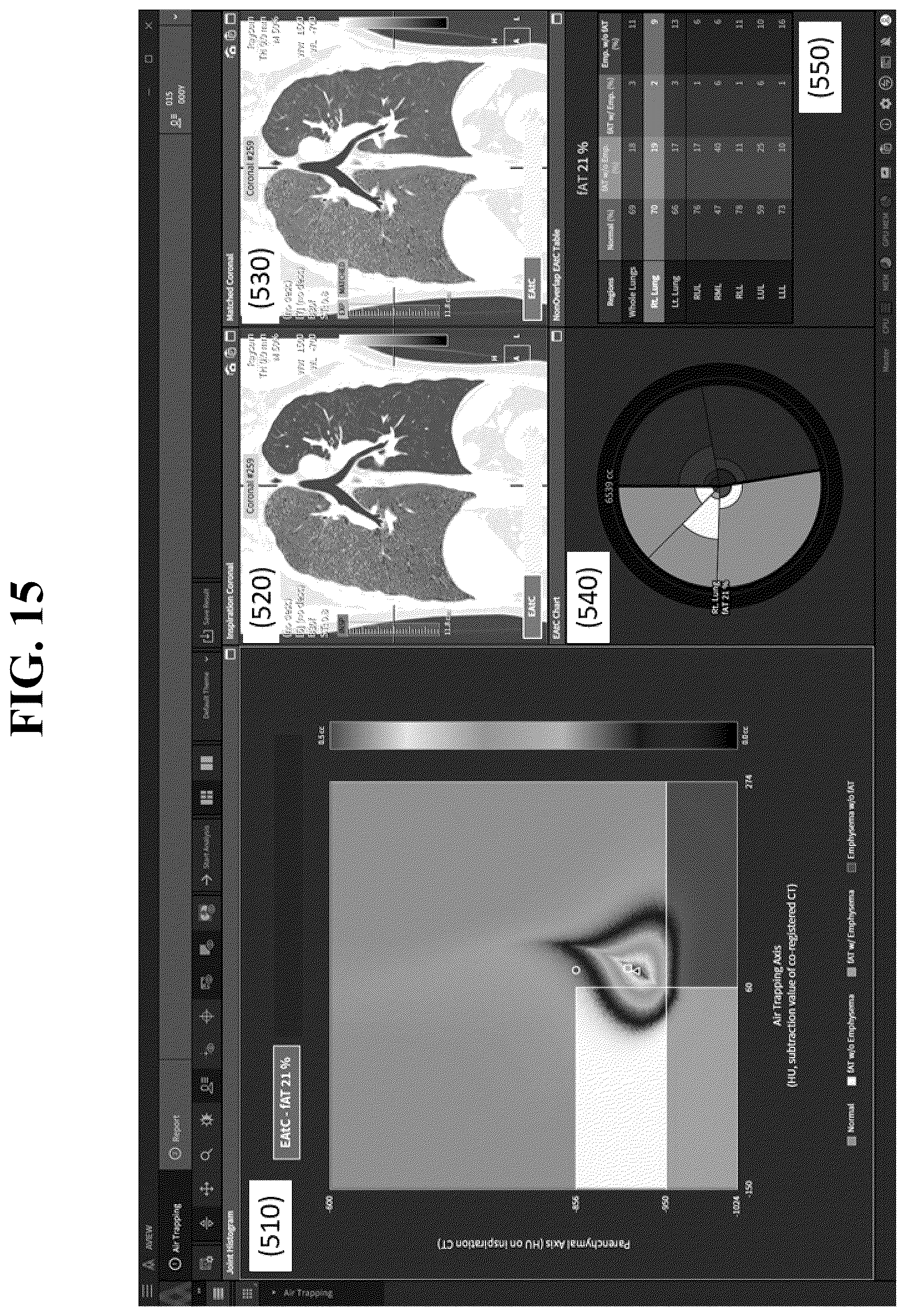 Patent US12602777 Figure 15 – Apparatus and method for quantitative assessment of medical images for diagnosis of chronic obstructive pulmonary disease