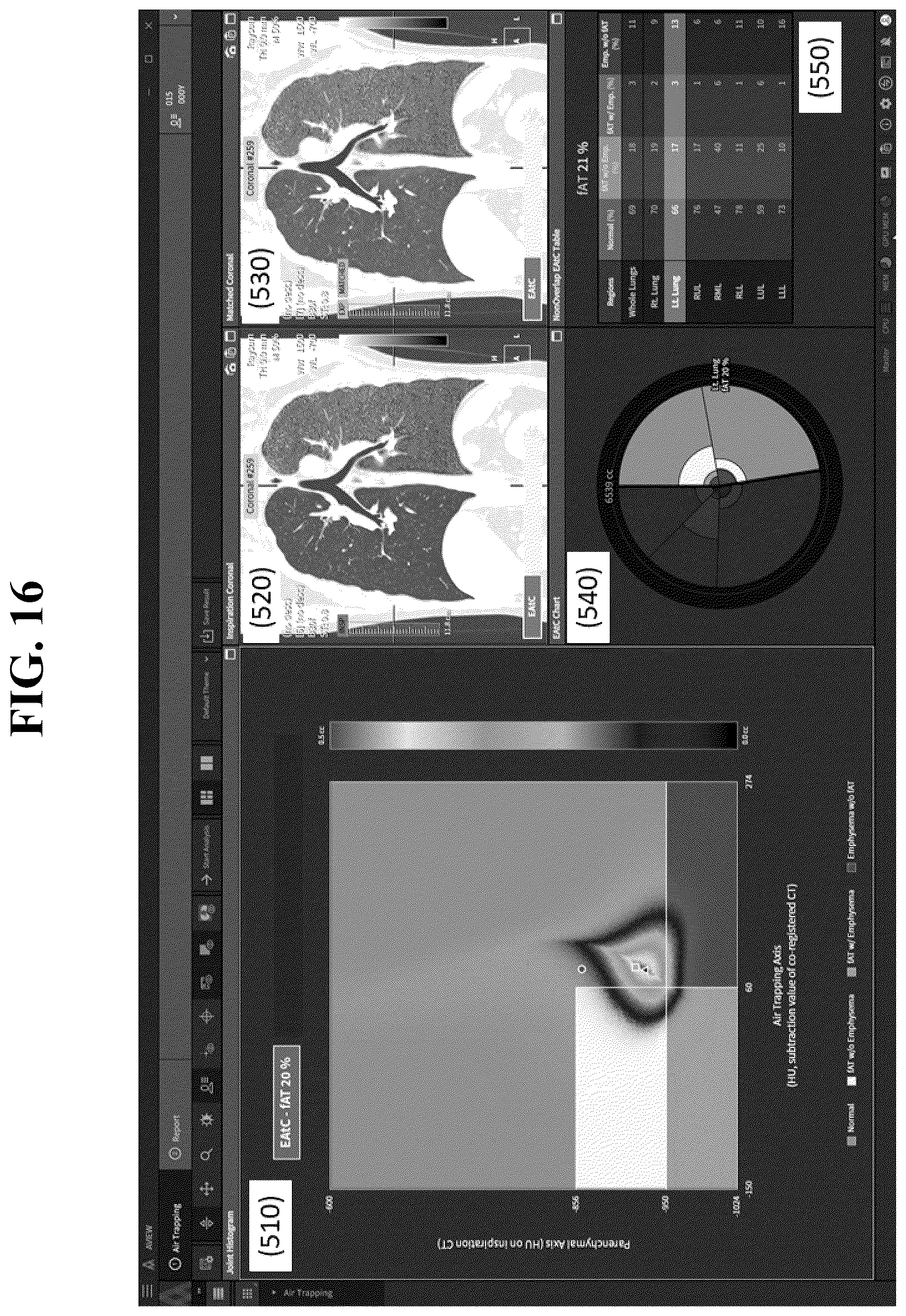 Patent US12602777 Figure 16 – Apparatus and method for quantitative assessment of medical images for diagnosis of chronic obstructive pulmonary disease