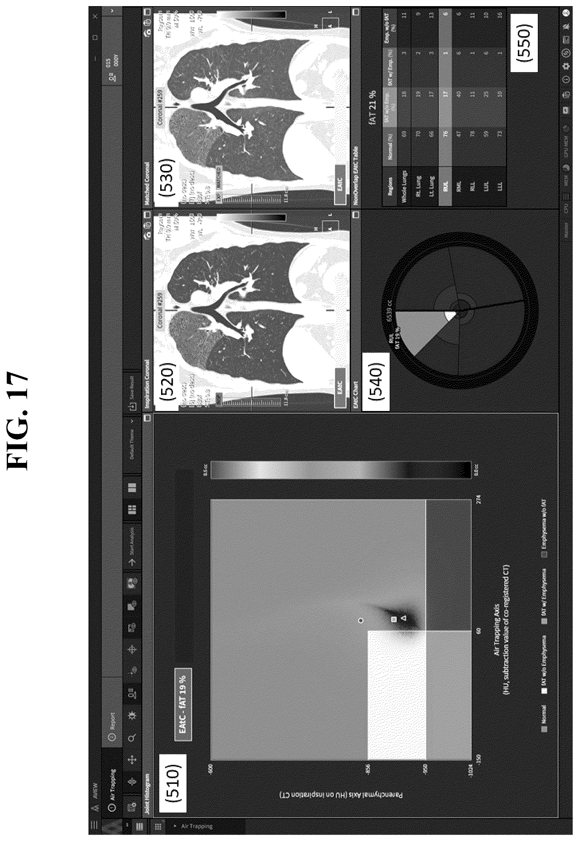 Patent US12602777 Figure 17 – Apparatus and method for quantitative assessment of medical images for diagnosis of chronic obstructive pulmonary disease