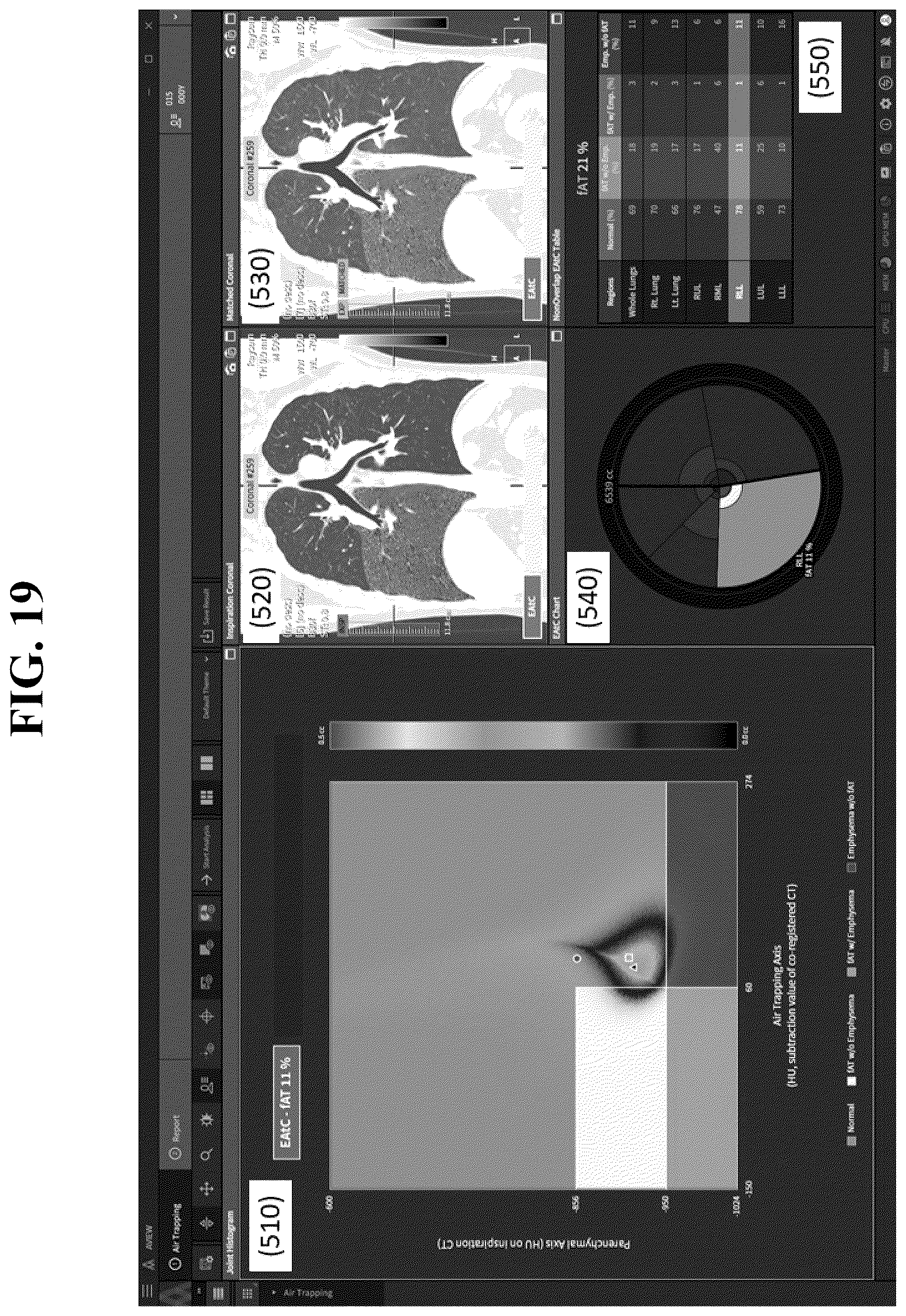 Patent US12602777 Figure 19 – Apparatus and method for quantitative assessment of medical images for diagnosis of chronic obstructive pulmonary disease