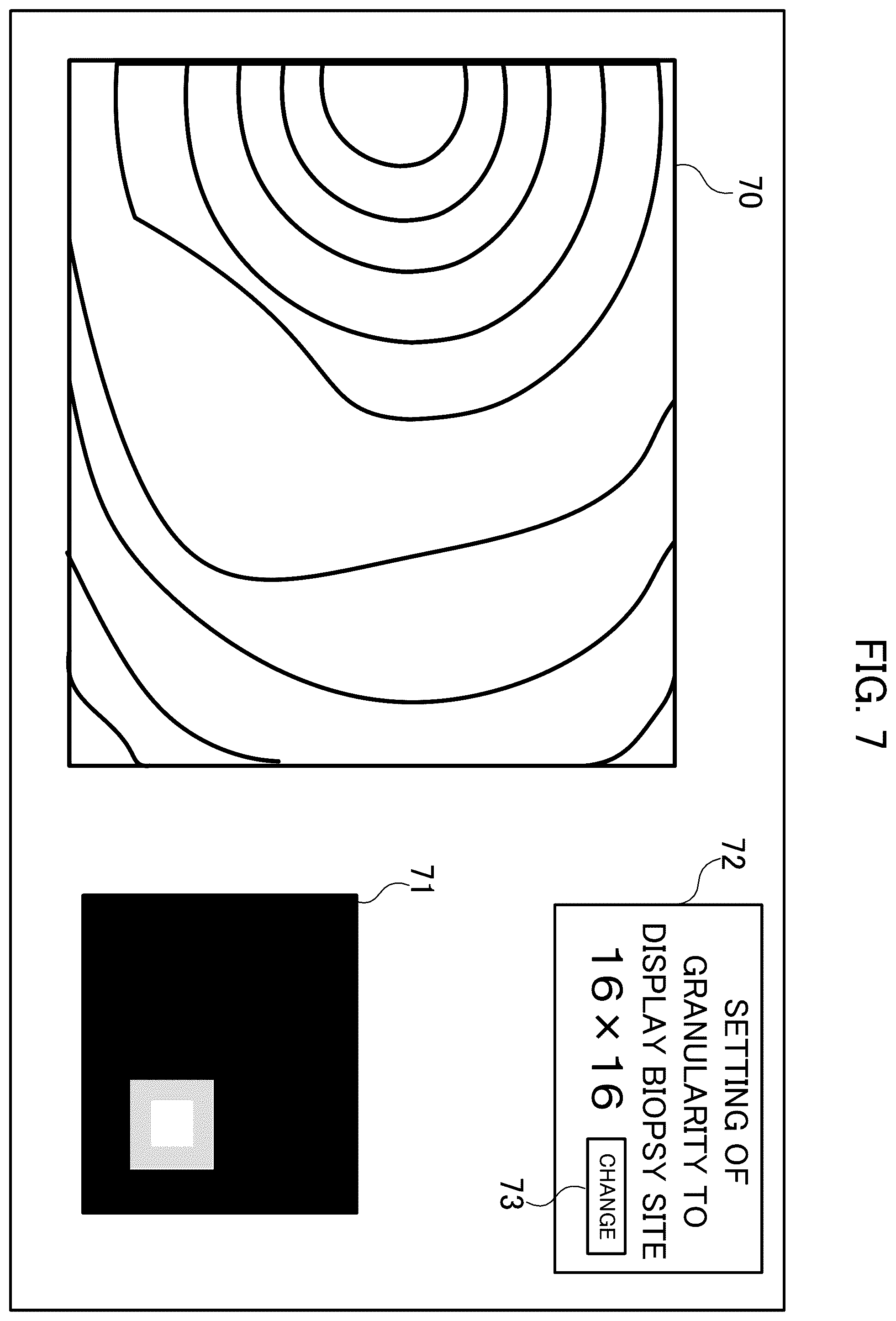 Patent US12602779 Figure 7 – Image processing device, image processing method and storage medium