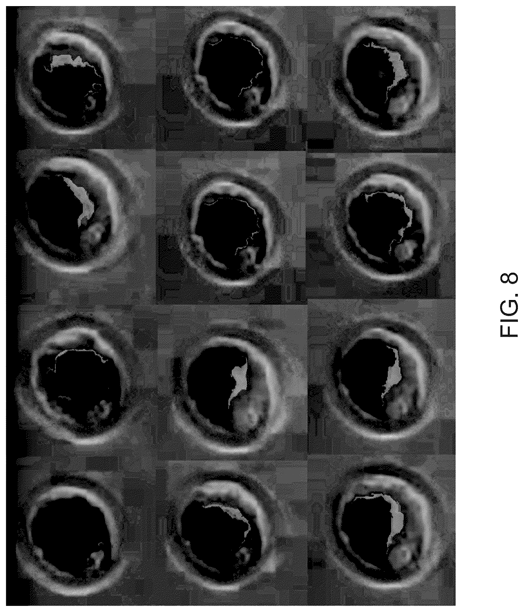 Patent US12602785 Figure 7 – Training a machine learning model to assess embryo characteristics from video image data