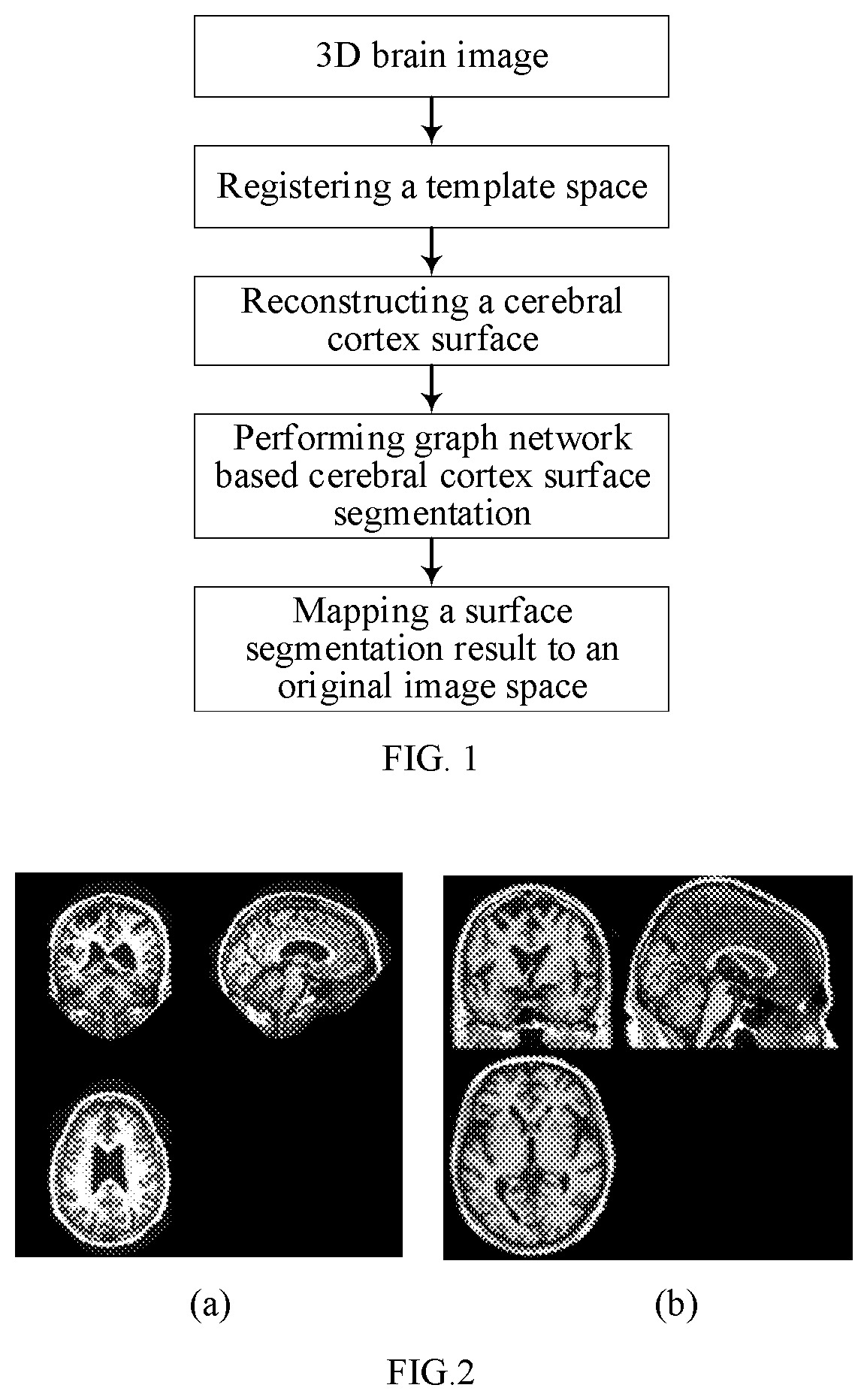 Patent US12602788 Figure 1 – Method and system for fully automatically segmenting cerebral cortex surface based on graph network