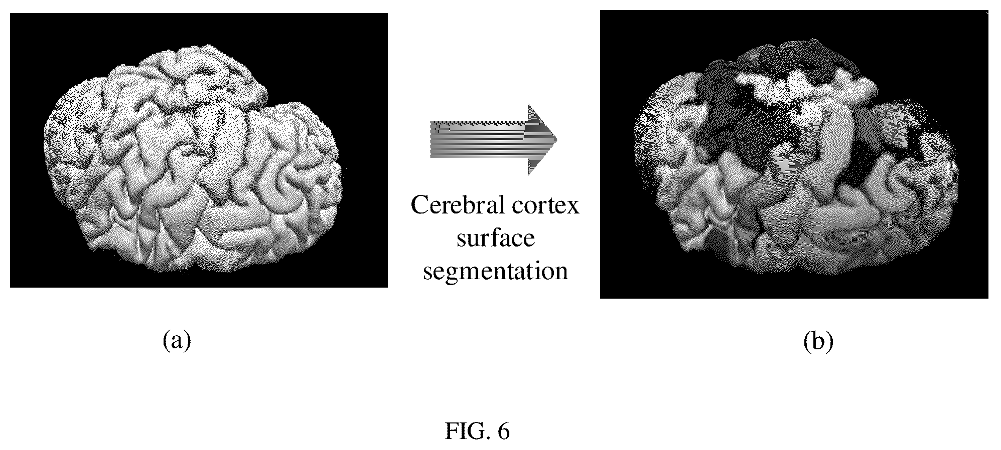 Patent US12602788 Figure 3 – Method and system for fully automatically segmenting cerebral cortex surface based on graph network