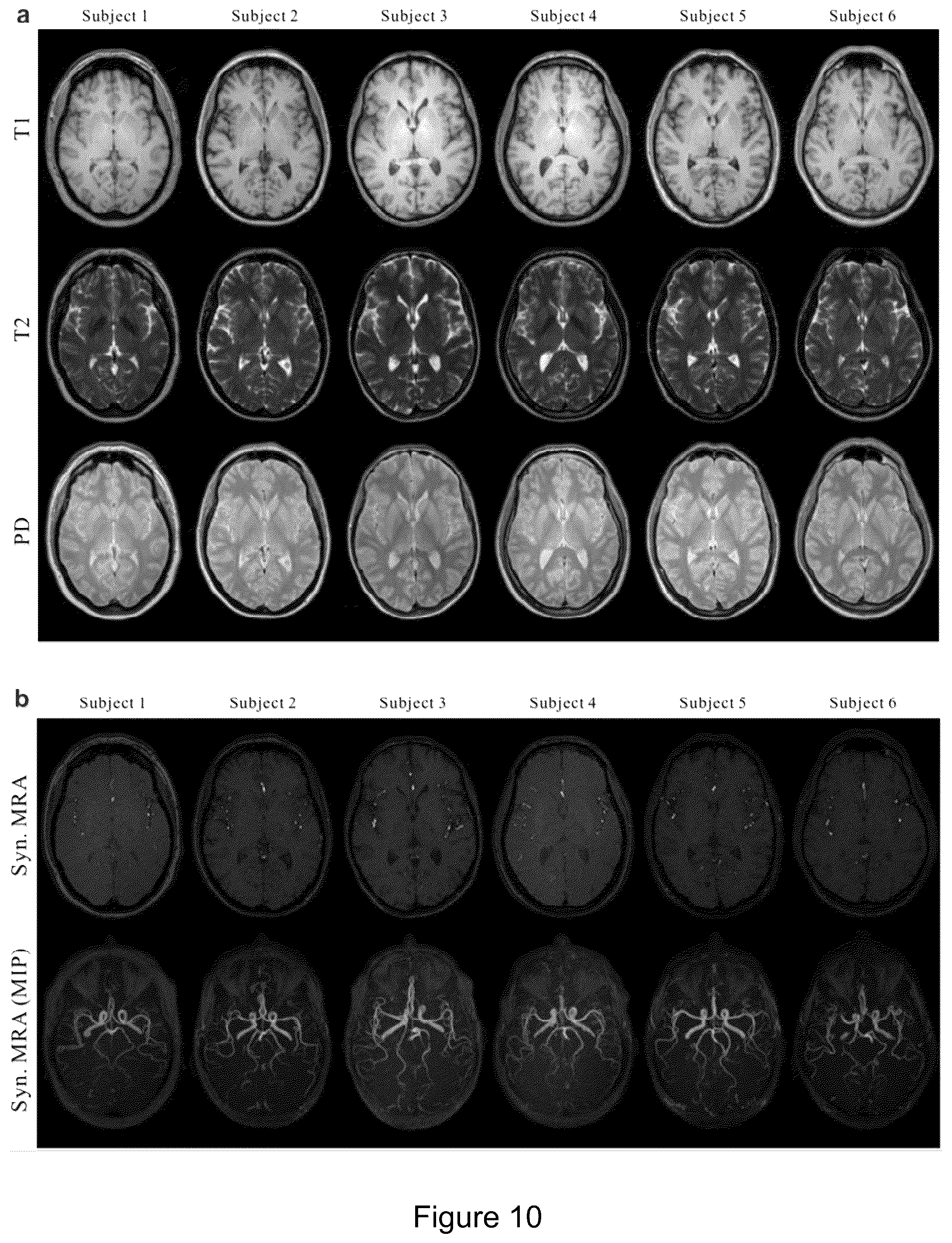 Patent US12602798 Figure 7 – Method and apparatus for generating subject-specific magnetic resonance angiography images from other multi-contrast magnetic resonance images