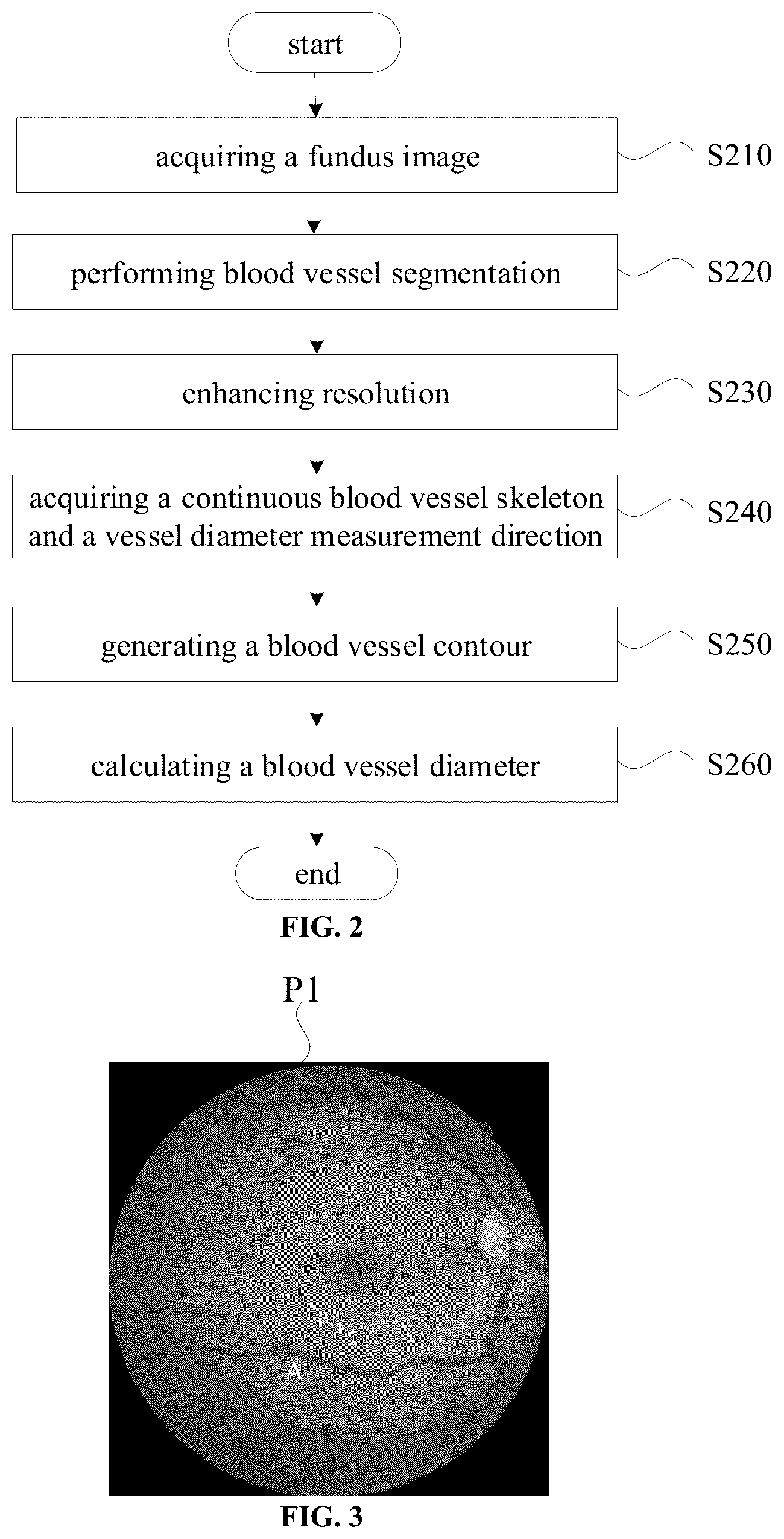 Patent US12602809 Figure 2 – Measuring method and measuring apparatus of blood vessel diameter of fundus image