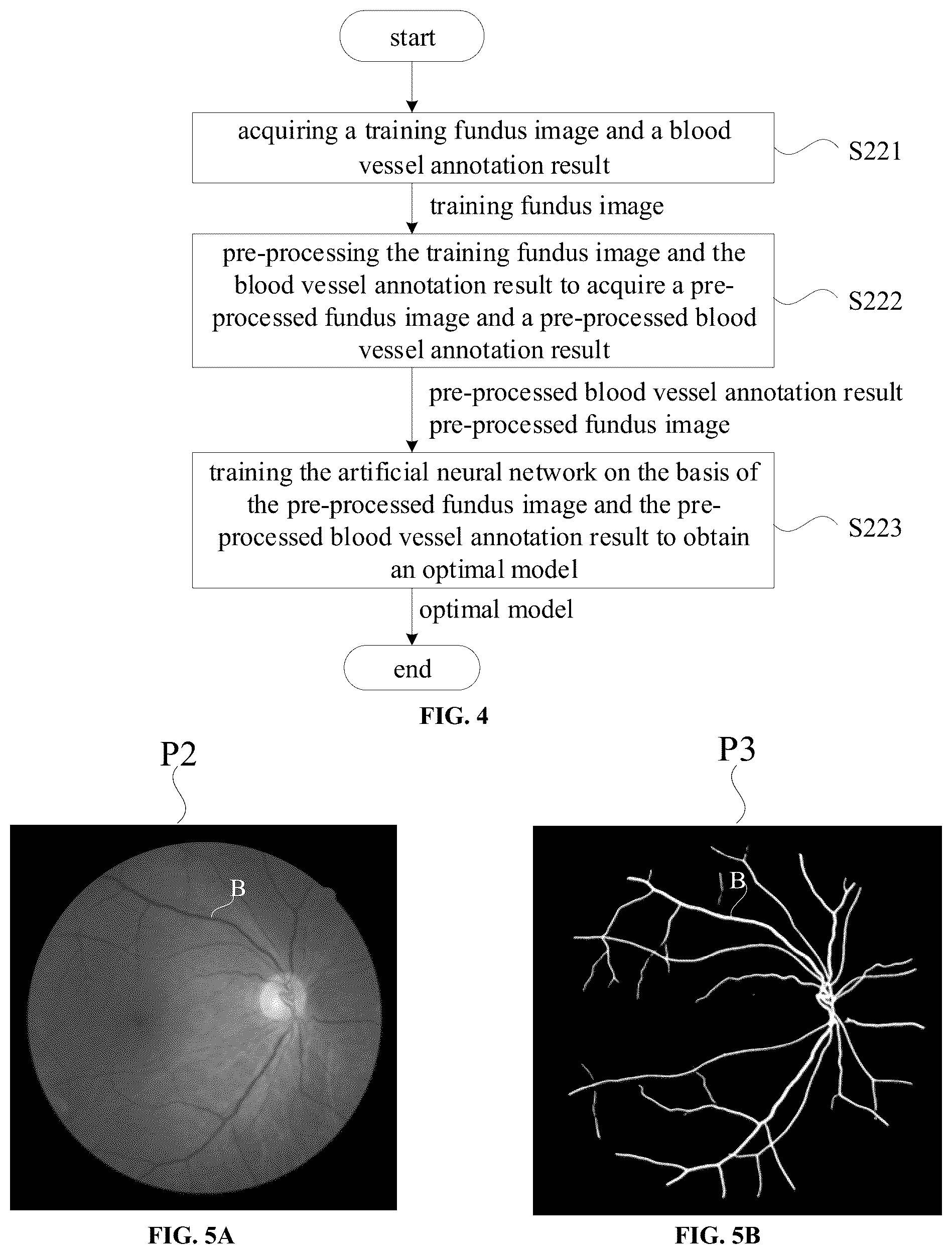 Patent US12602809 Figure 3 – Measuring method and measuring apparatus of blood vessel diameter of fundus image