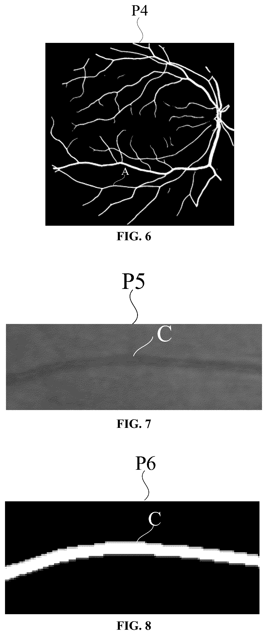 Patent US12602809 Figure 4 – Measuring method and measuring apparatus of blood vessel diameter of fundus image