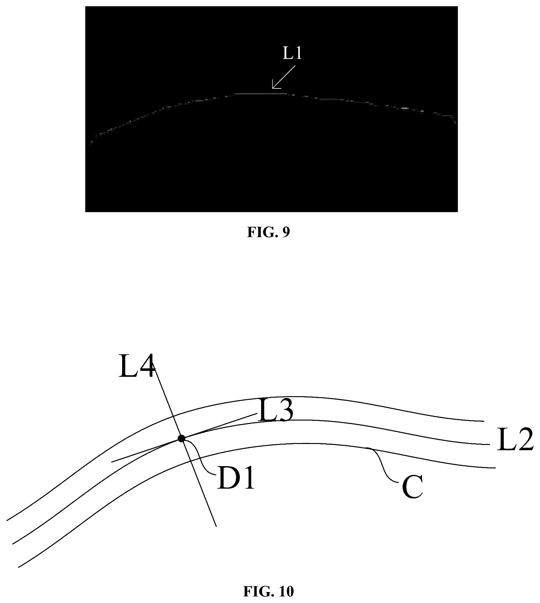 Patent US12602809 Figure 5 – Measuring method and measuring apparatus of blood vessel diameter of fundus image