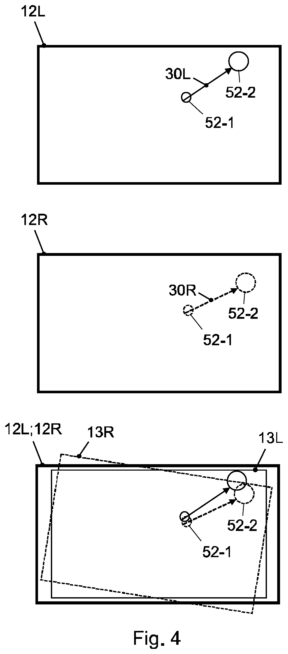 Patent US12602830 Figure 3 – Method for calibrating cameras of a multichannel medical visualization system and medical visualization system