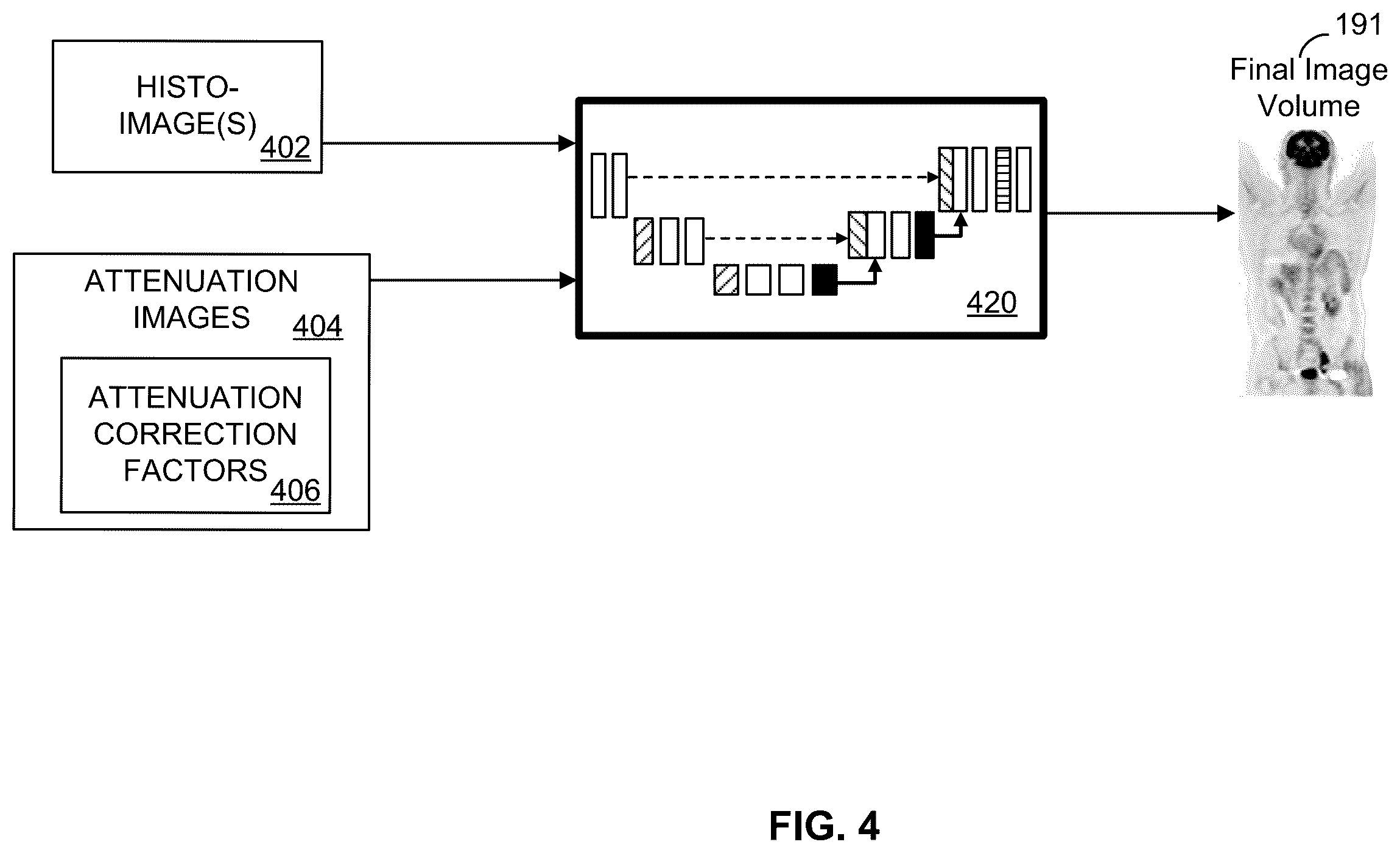 Patent US12602853 Figure 4 – Methods and apparatus for pet image reconstruction using multi-view histo-images of attenuation correction factors