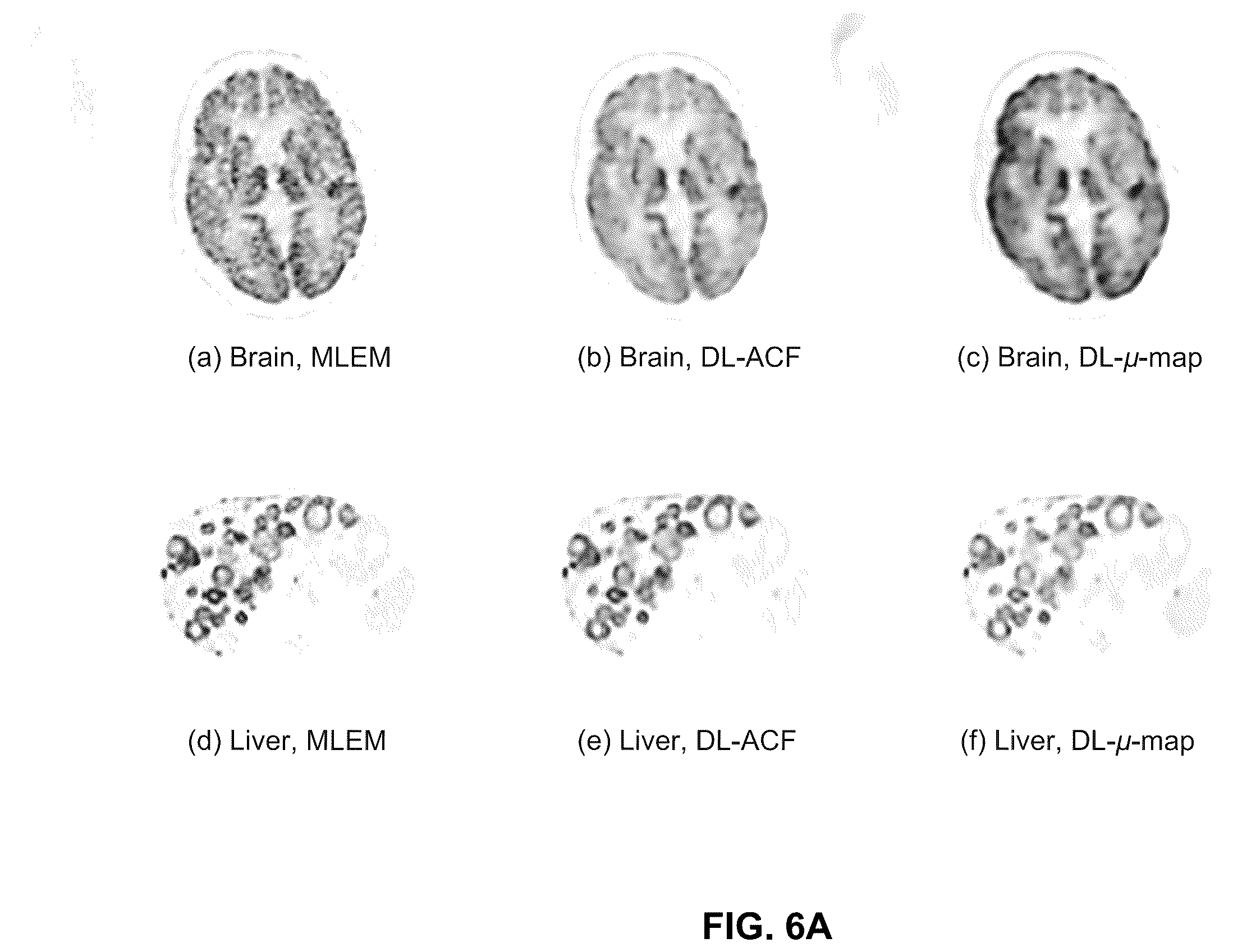 Patent US12602853 Figure 6 – Methods and apparatus for pet image reconstruction using multi-view histo-images of attenuation correction factors