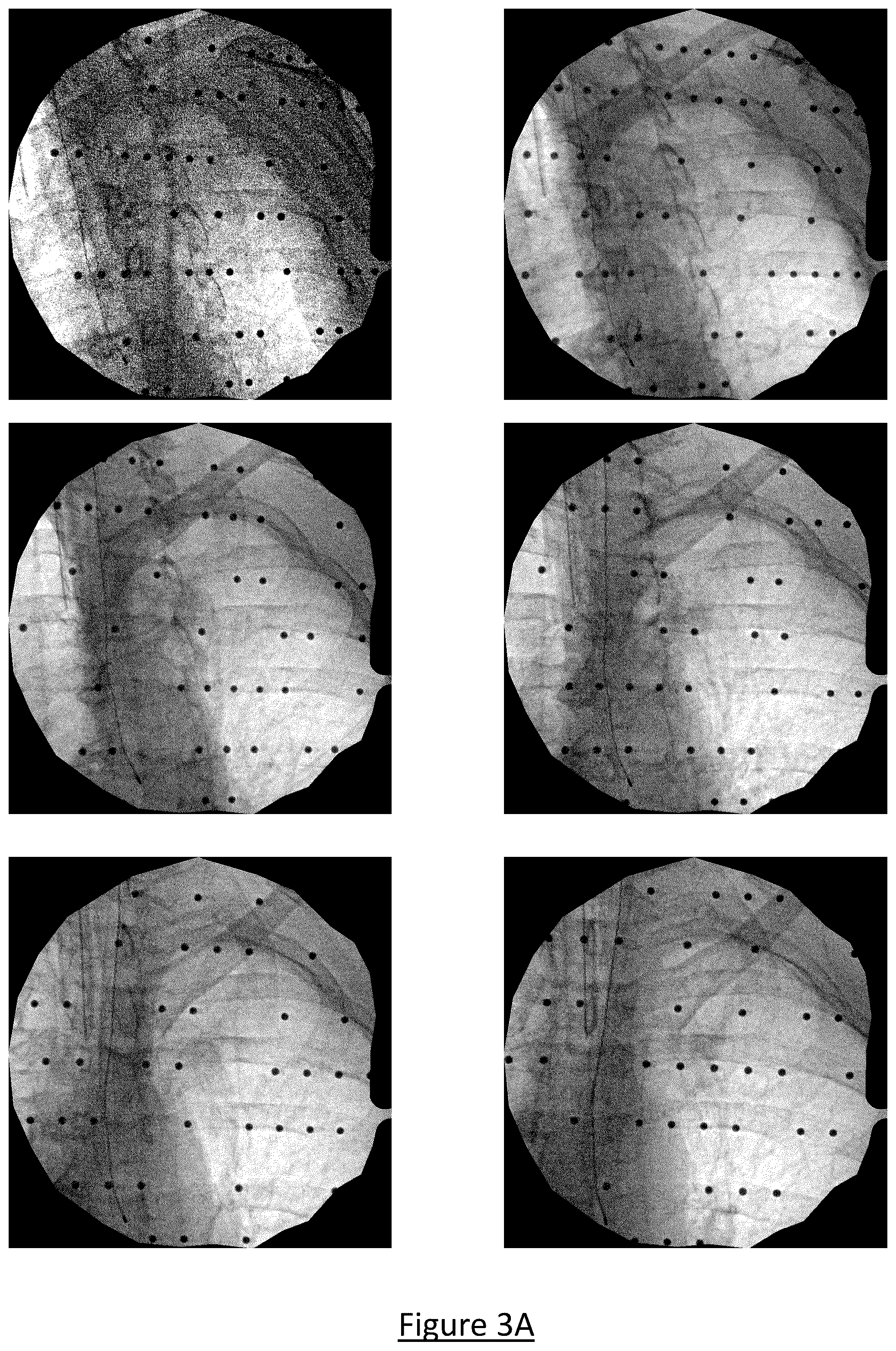 Patent US12602854 Figure 3 – System and method for medical imaging