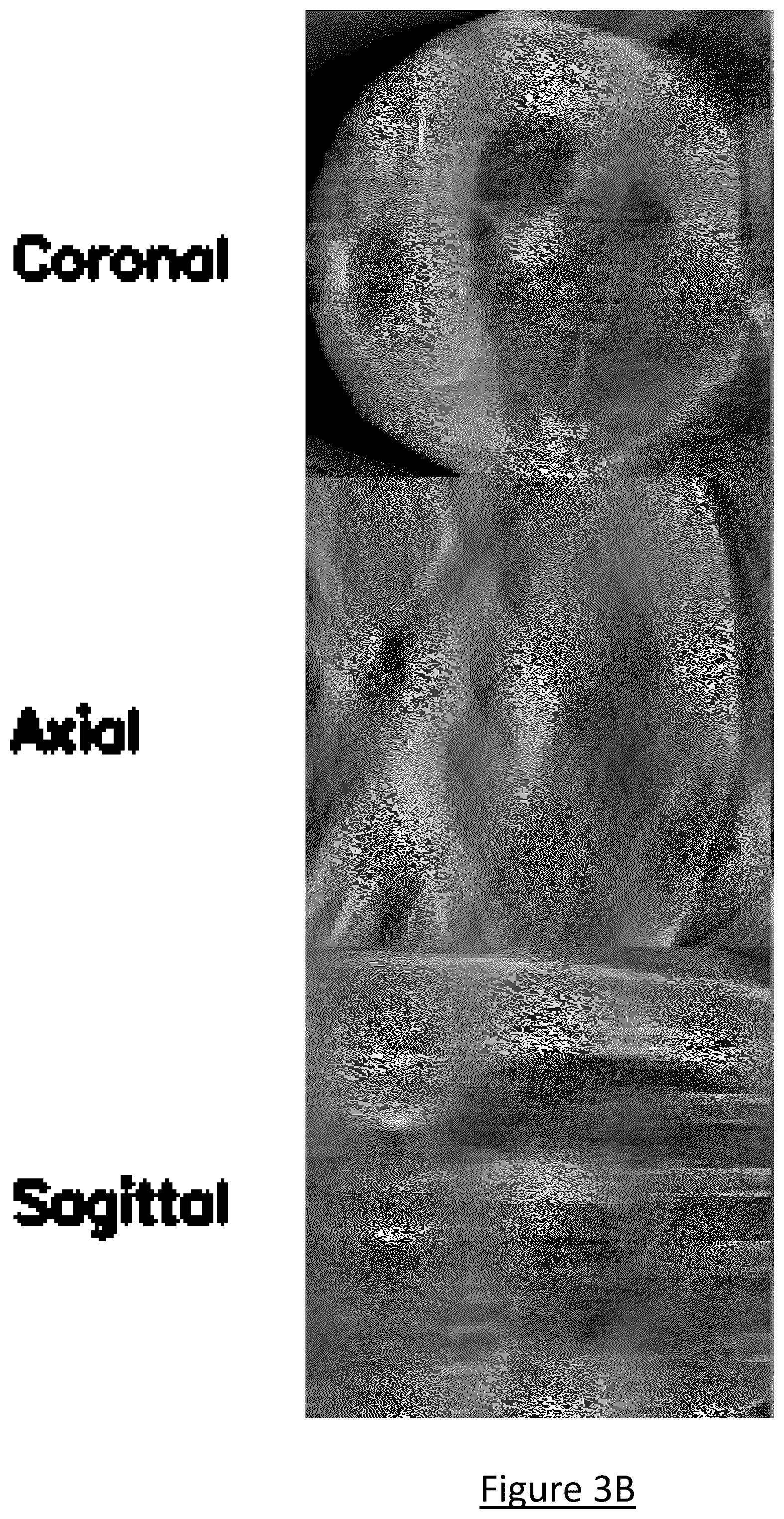 Patent US12602854 Figure 4 – System and method for medical imaging