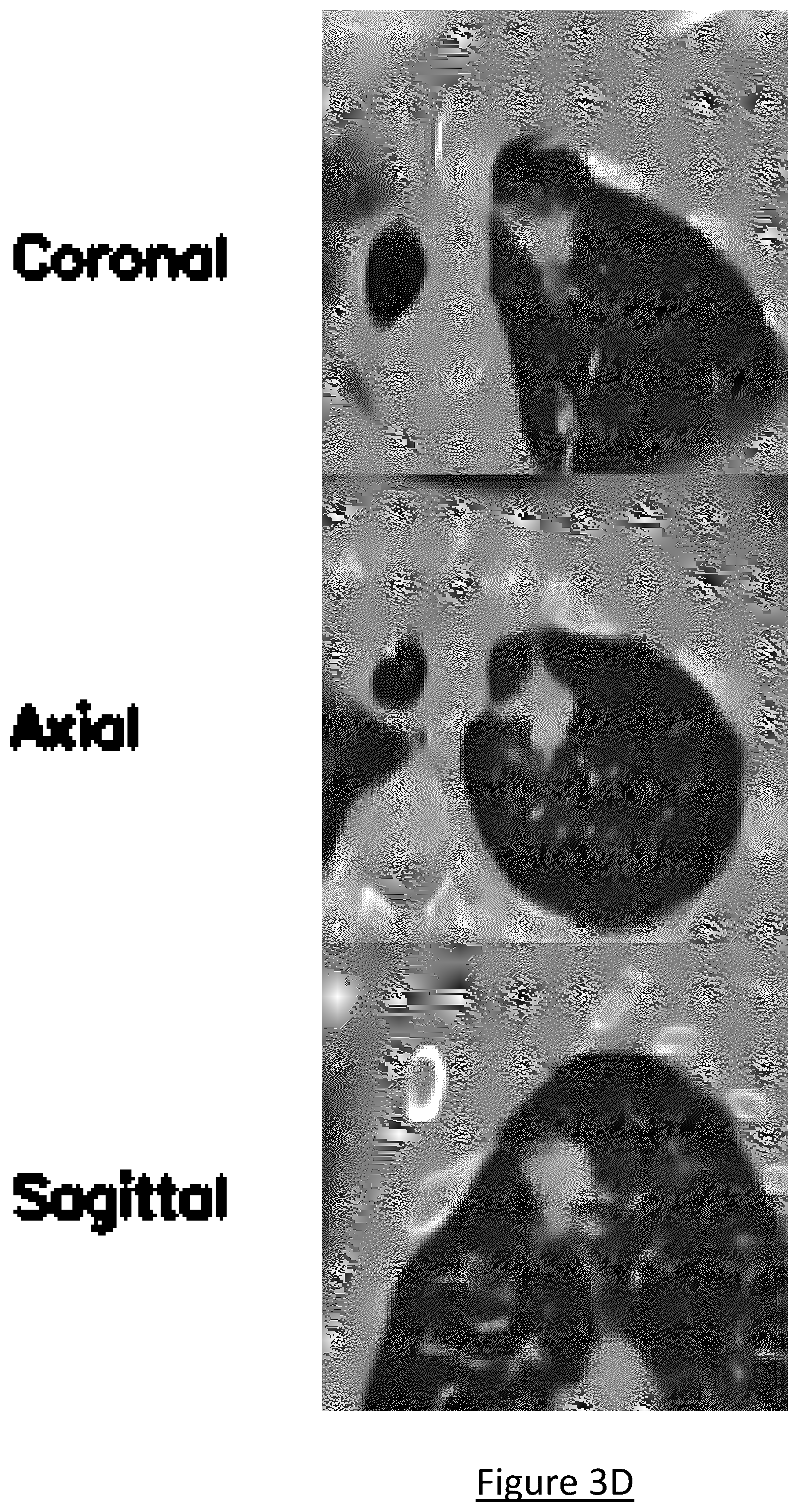 Patent US12602854 Figure 6 – System and method for medical imaging