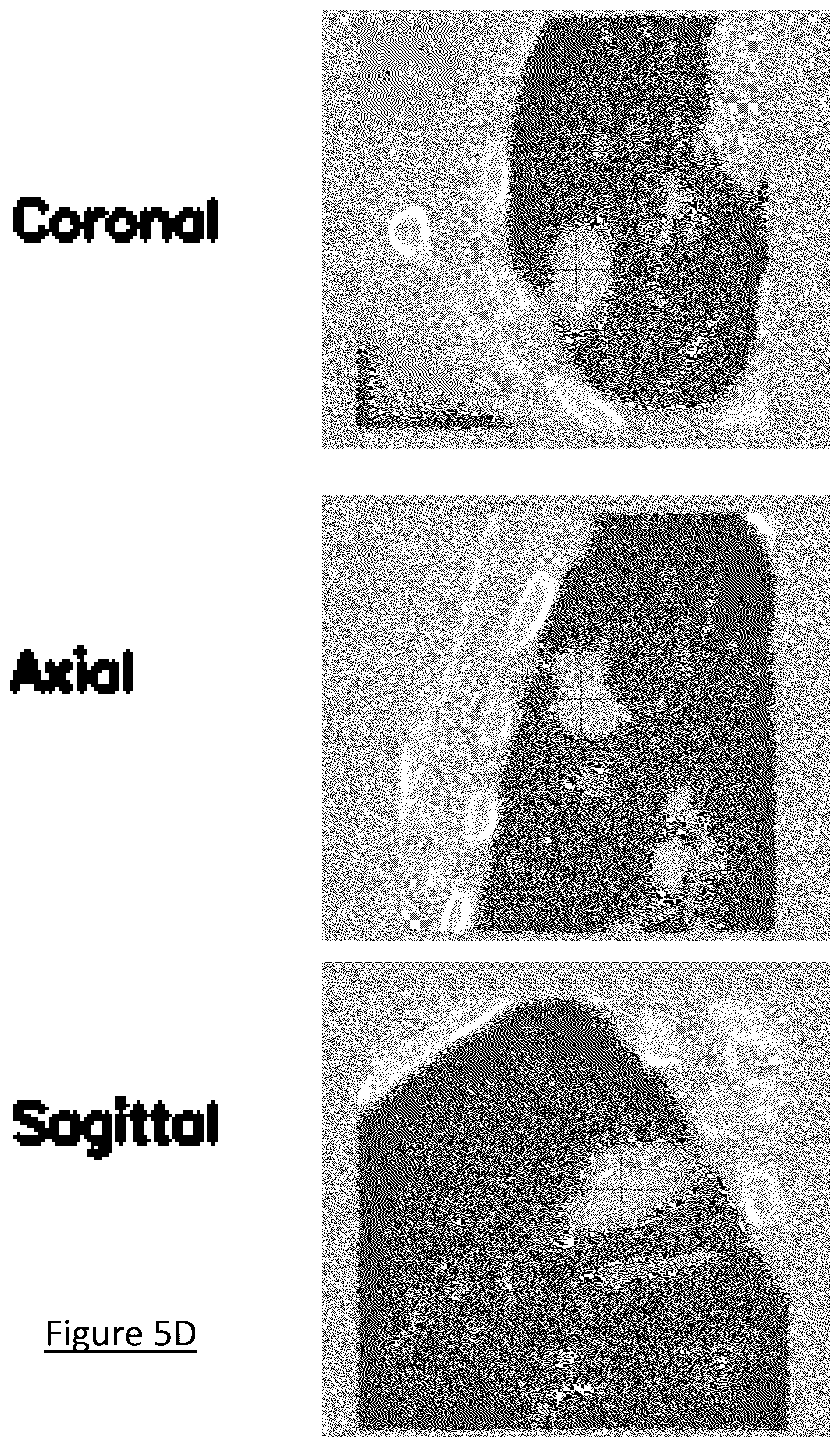 Patent US12602854 Figure 11 – System and method for medical imaging