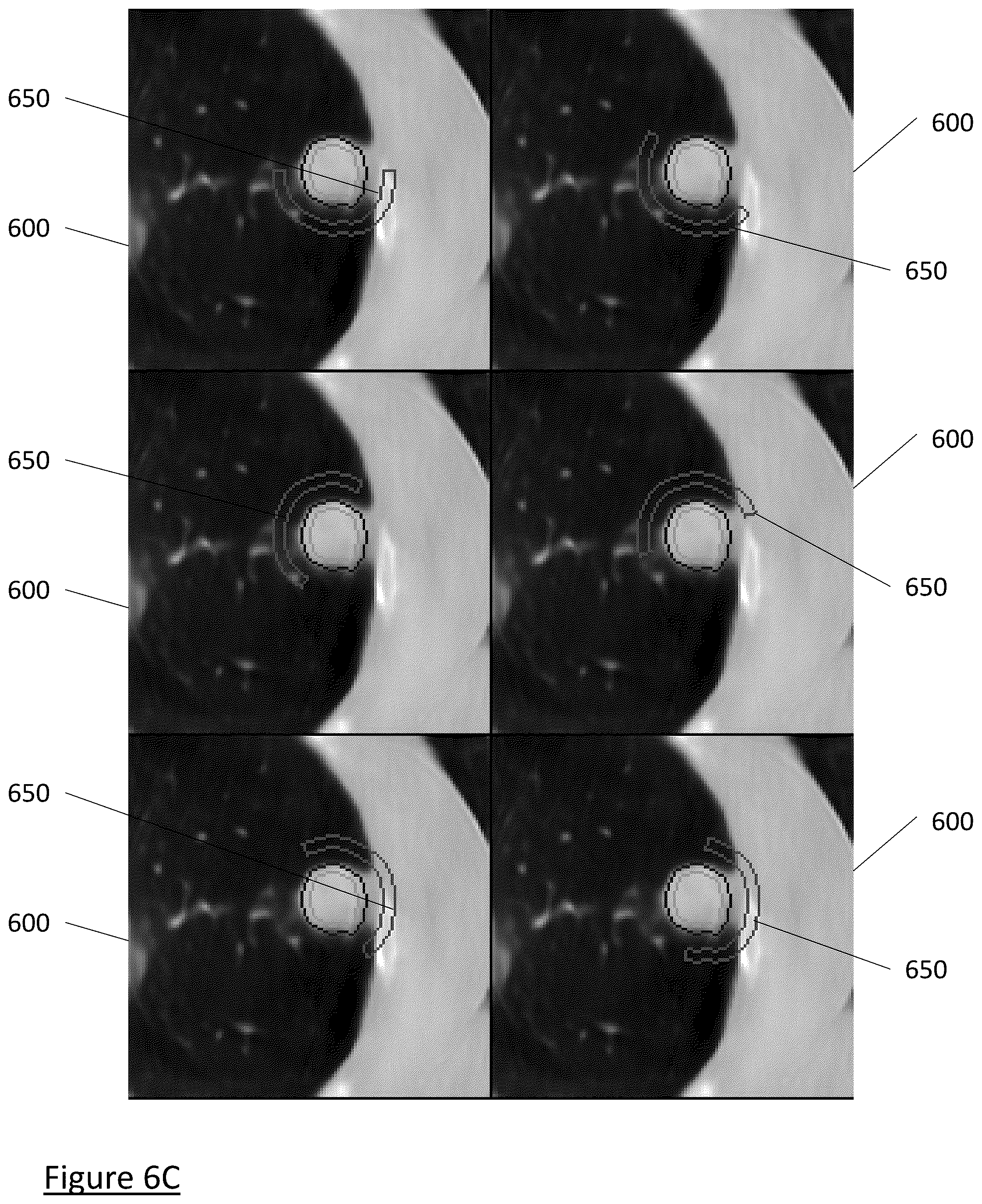 Patent US12602854 Figure 14 – System and method for medical imaging