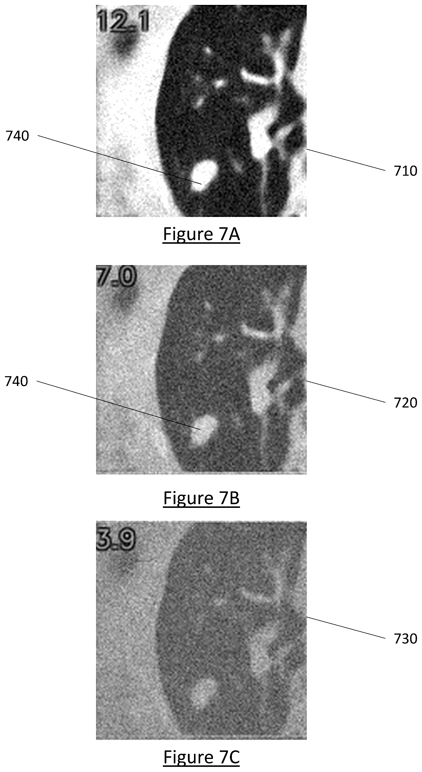 Patent US12602854 Figure 15 – System and method for medical imaging