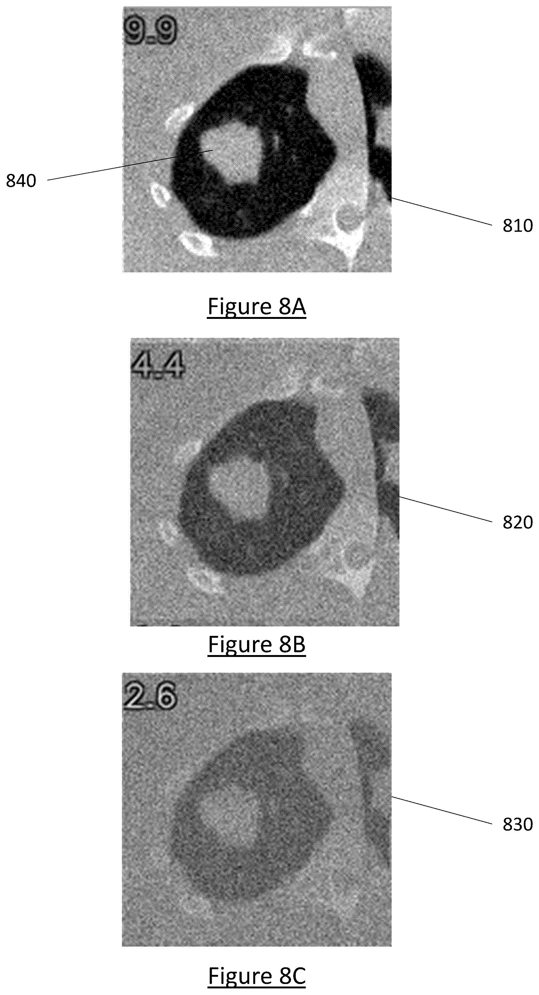 Patent US12602854 Figure 16 – System and method for medical imaging